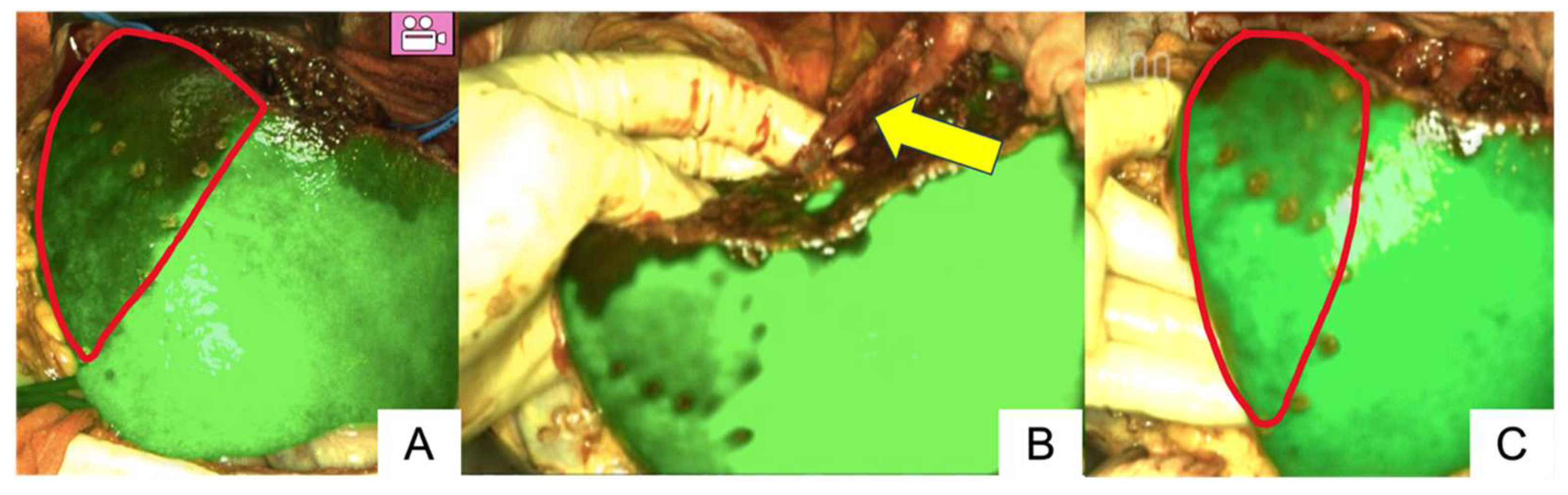 Cancers 17 00868 g002