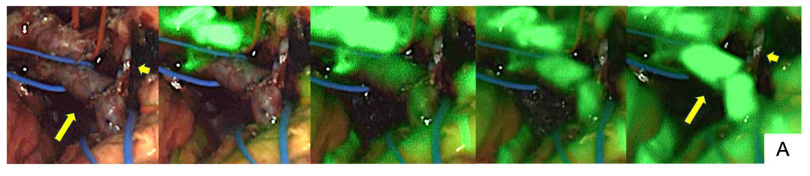 Cancers 17 00868 g003a