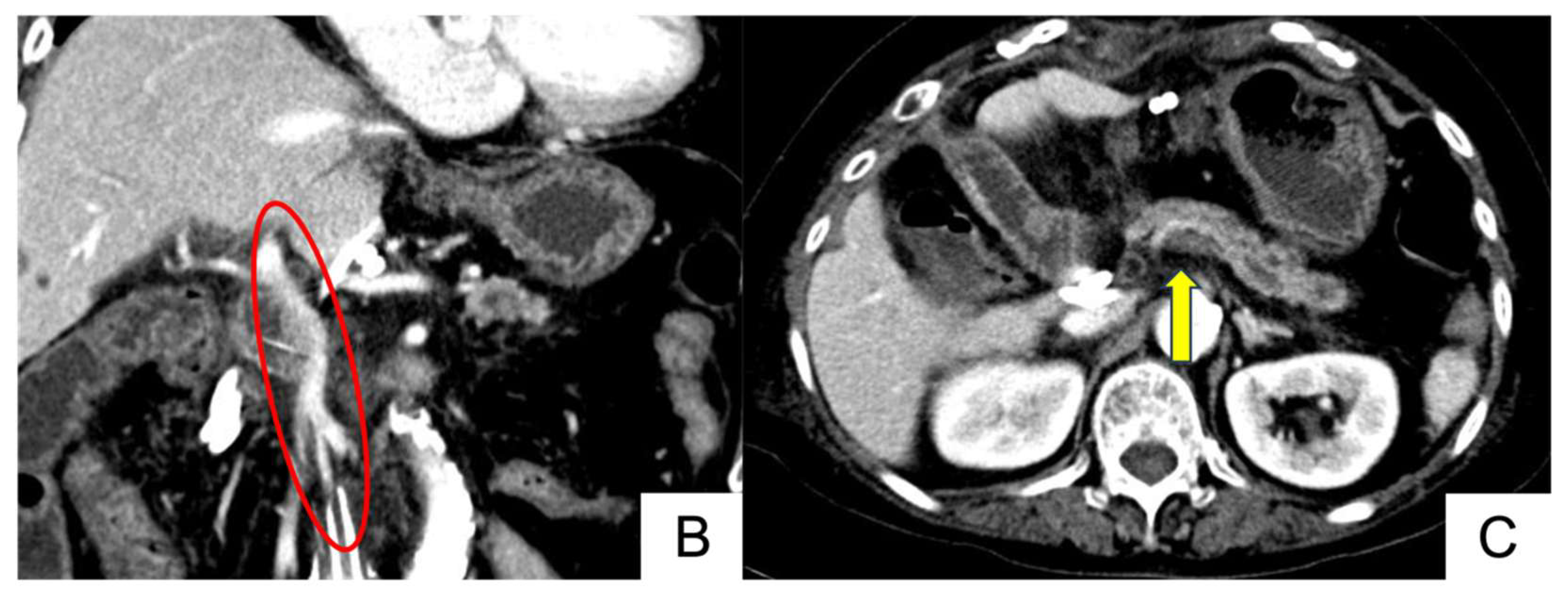 Cancers 17 00868 g003b