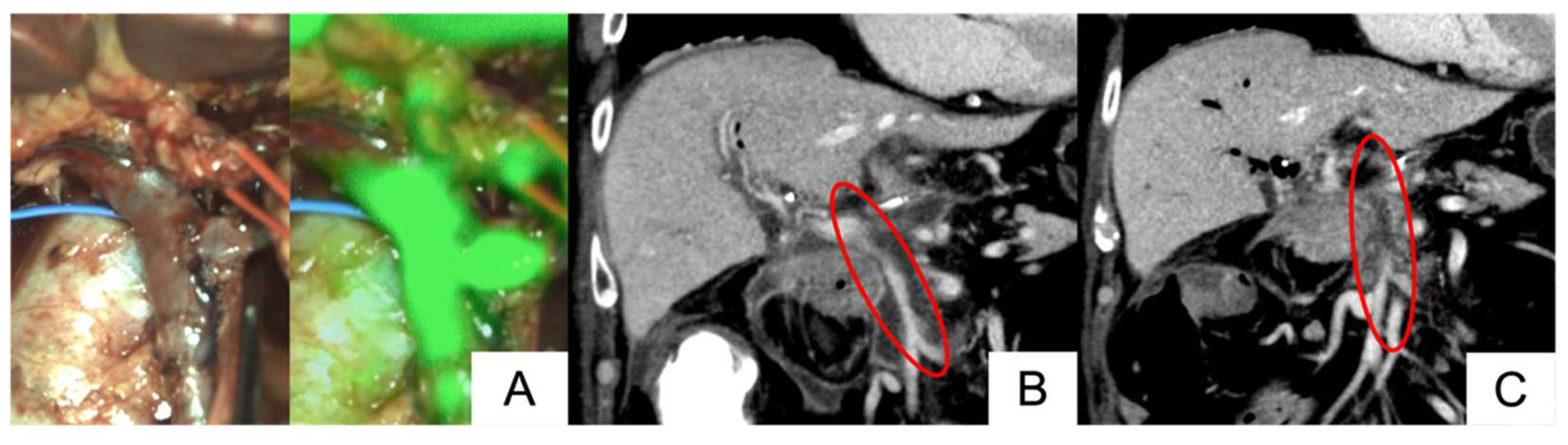 Cancers 17 00868 g004