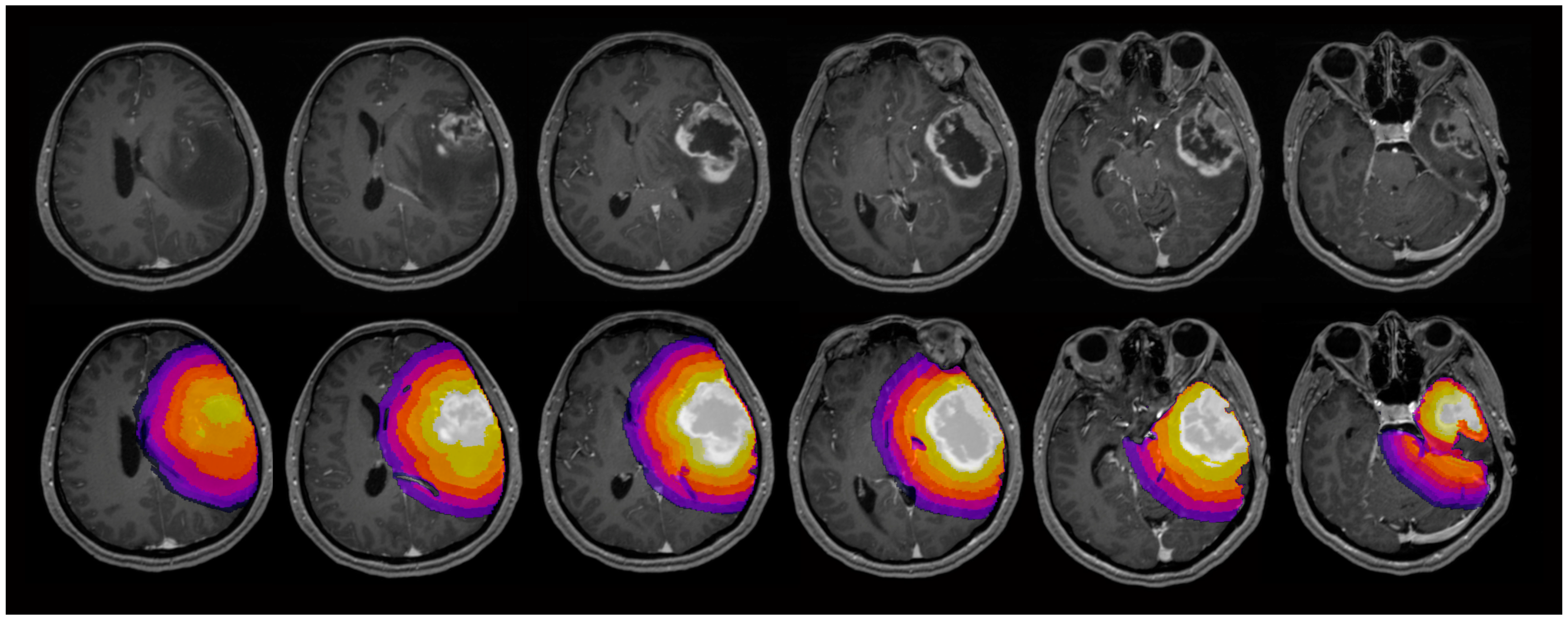 Cancers 17 00876 g001