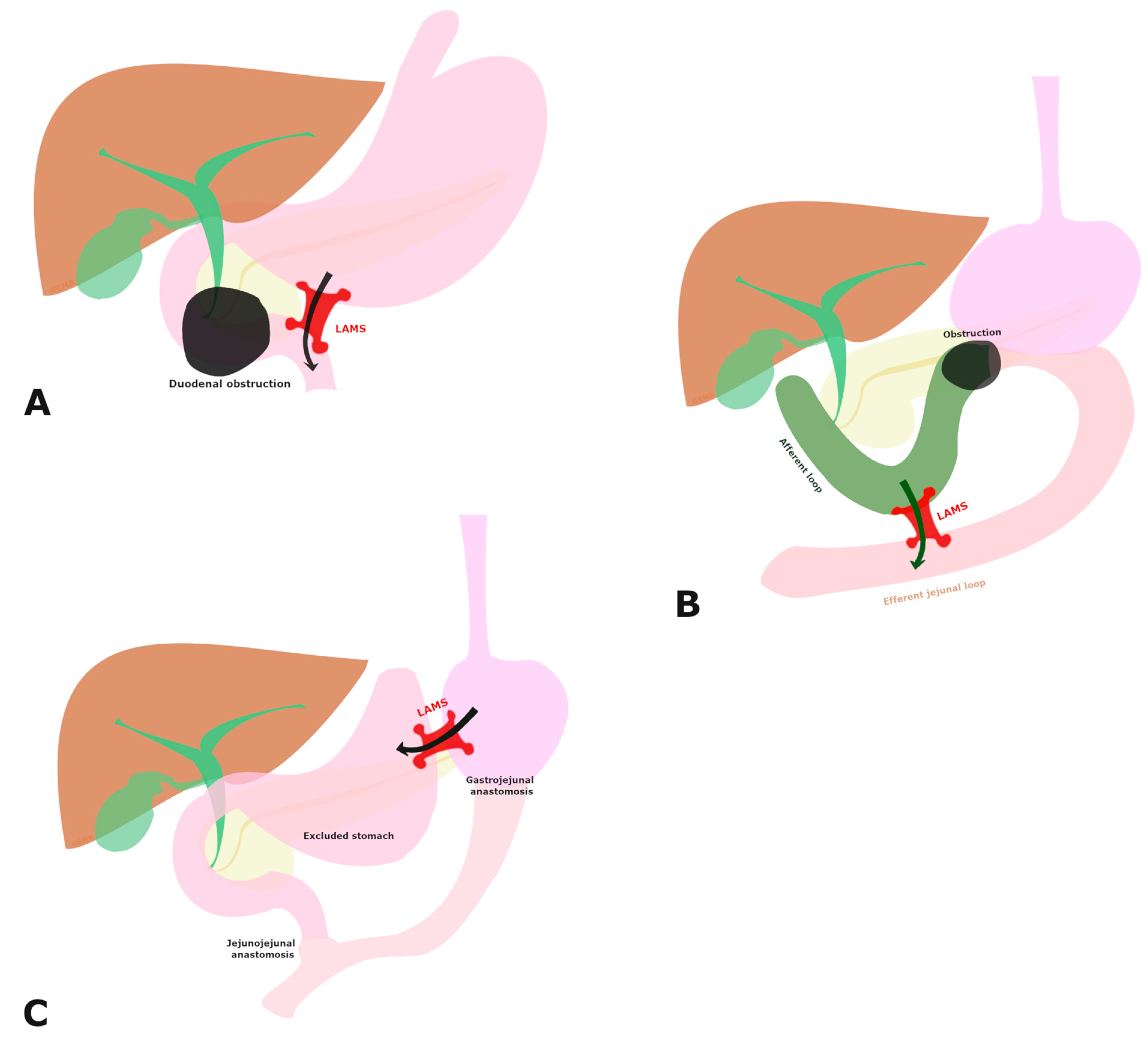 Cancers 17 00910 g002