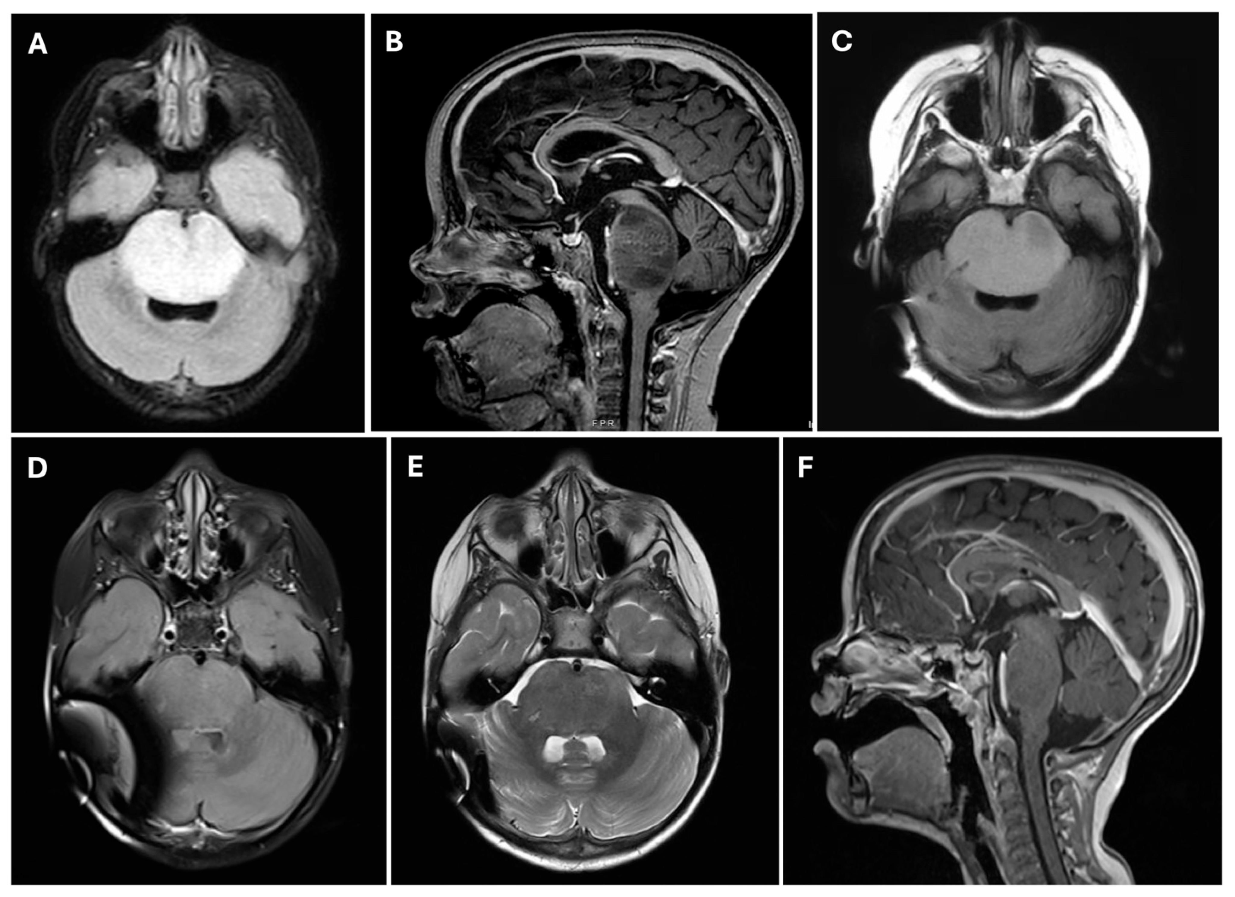 Cancers 17 00931 g002