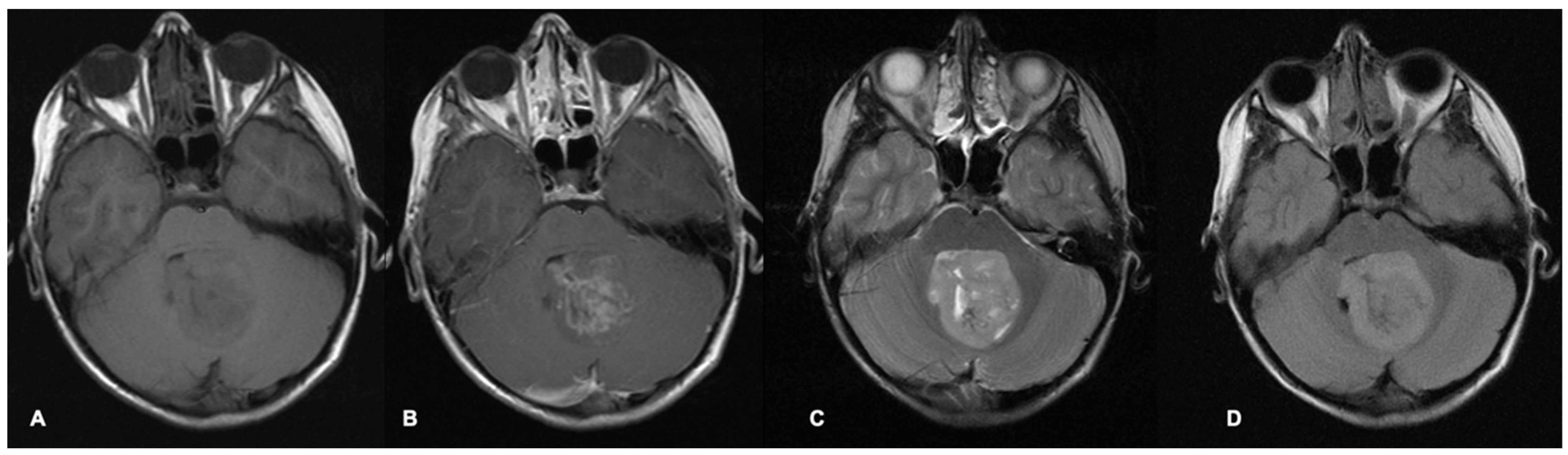 Cancers 17 00947 g001 Cancers 17 00947 g001