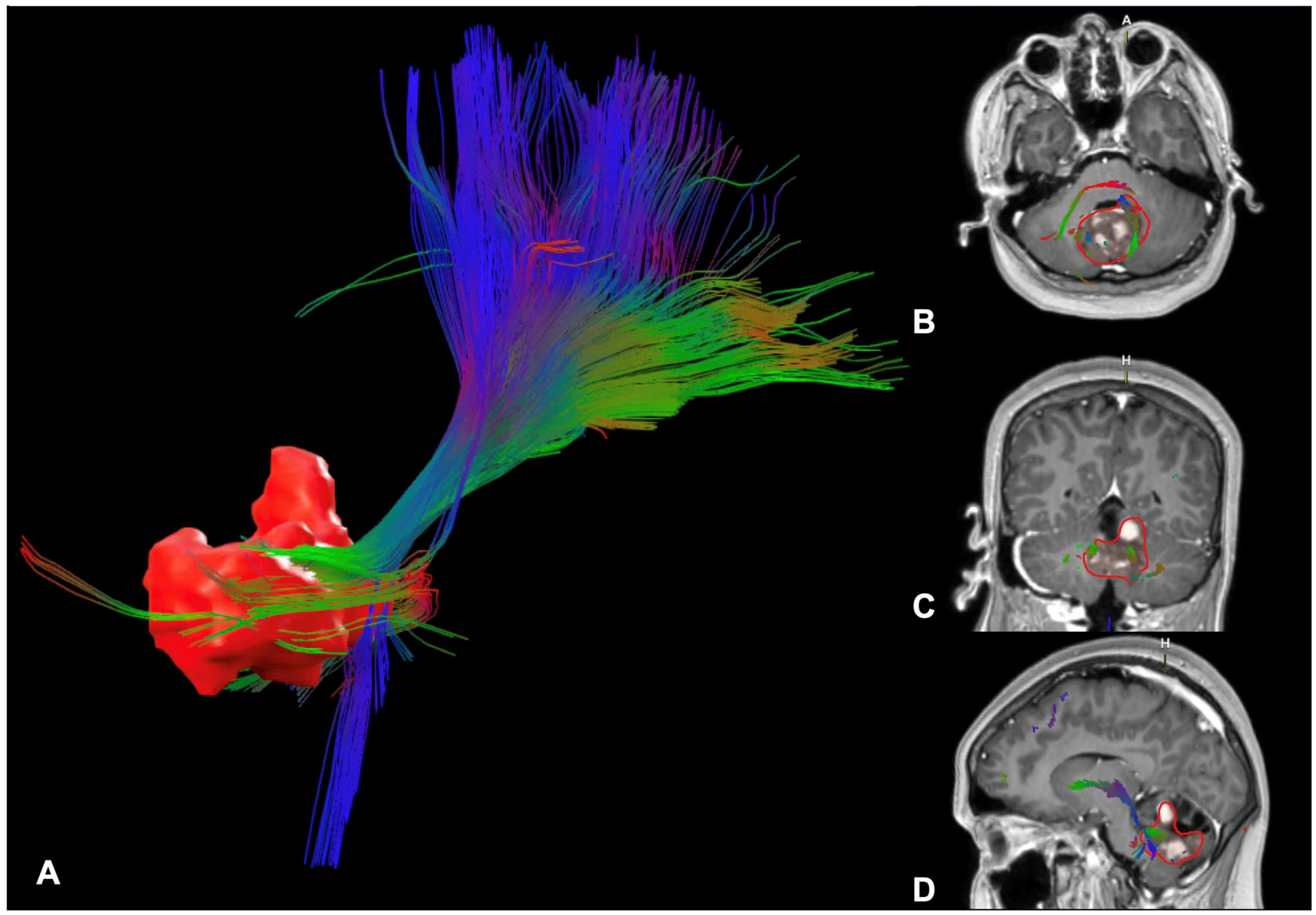 Cancers 17 00947 g004 Cancers 17 00947 g004