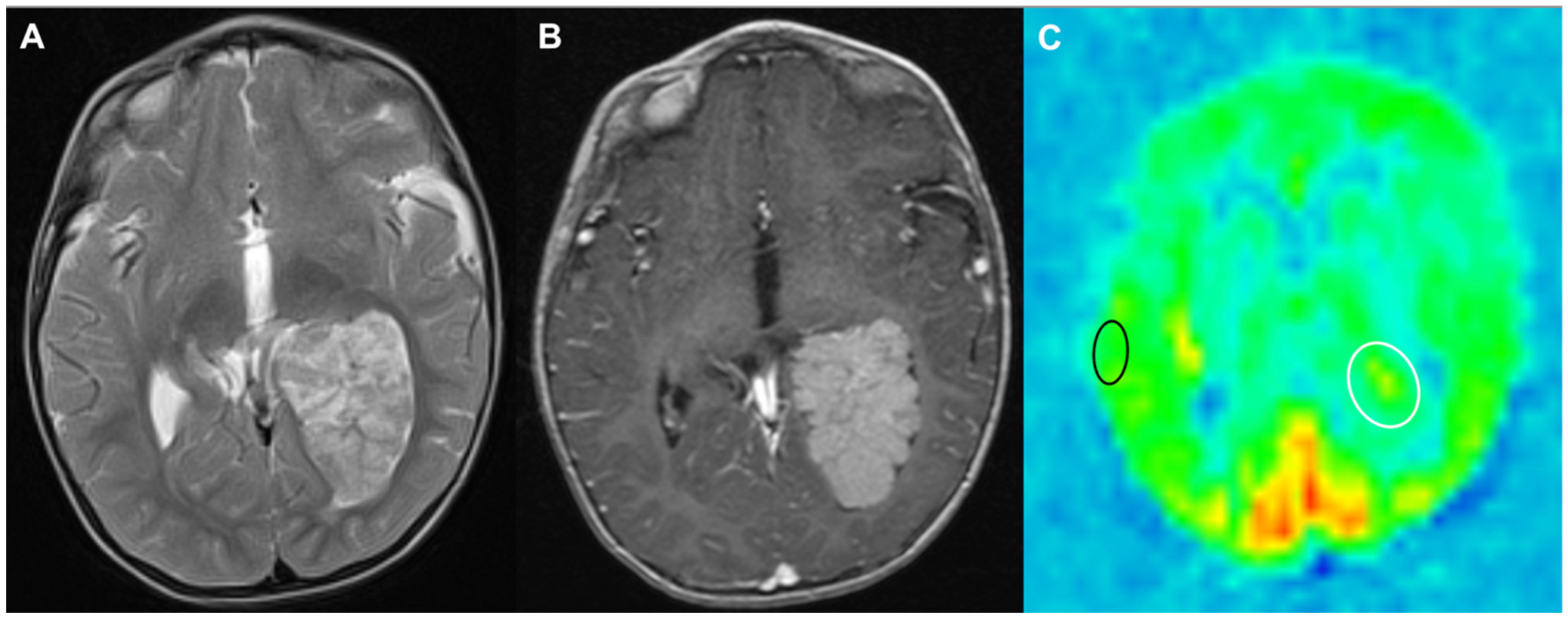 Cancers 17 00947 g005 Cancers 17 00947 g005