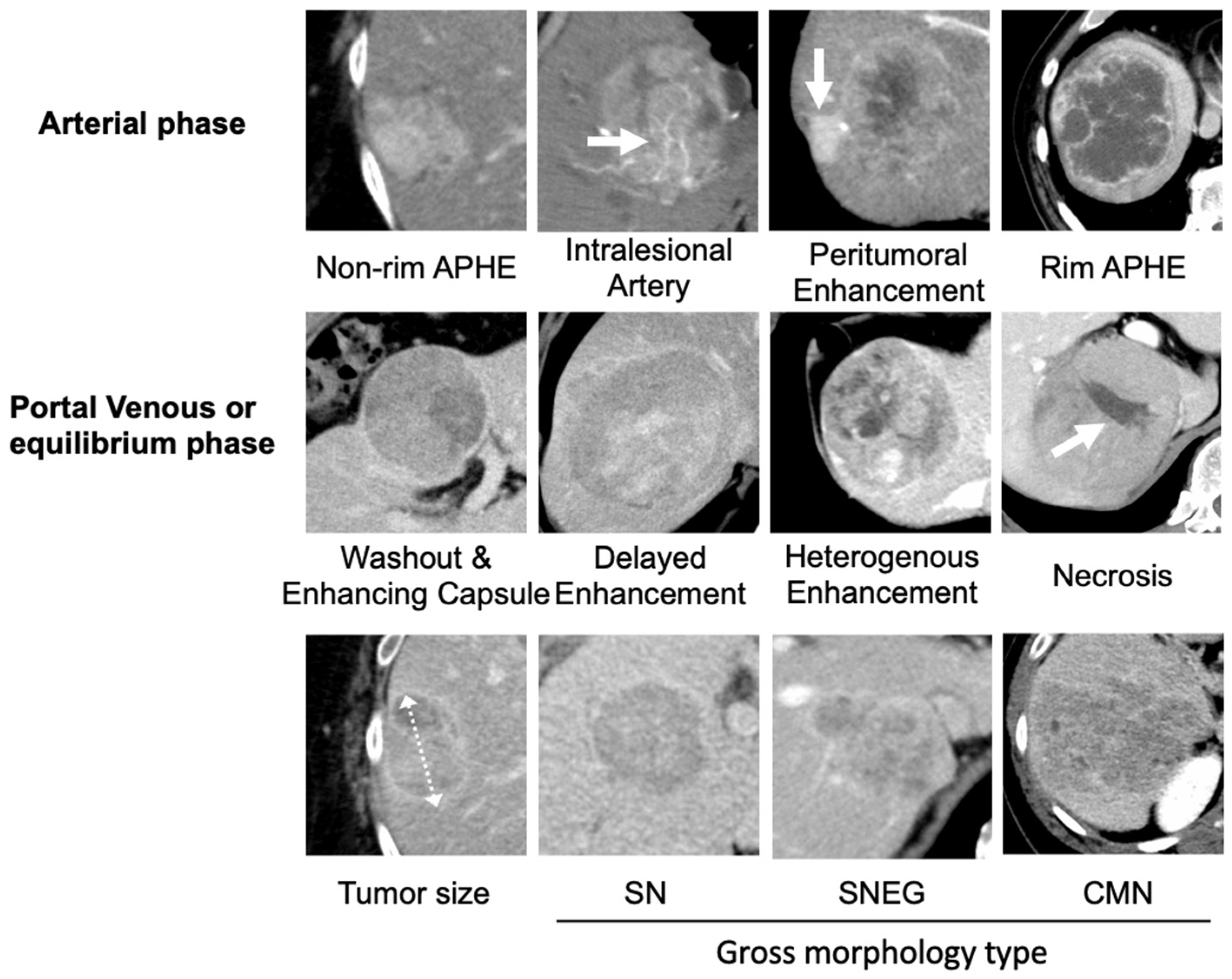 Cancers 17 00948 g003