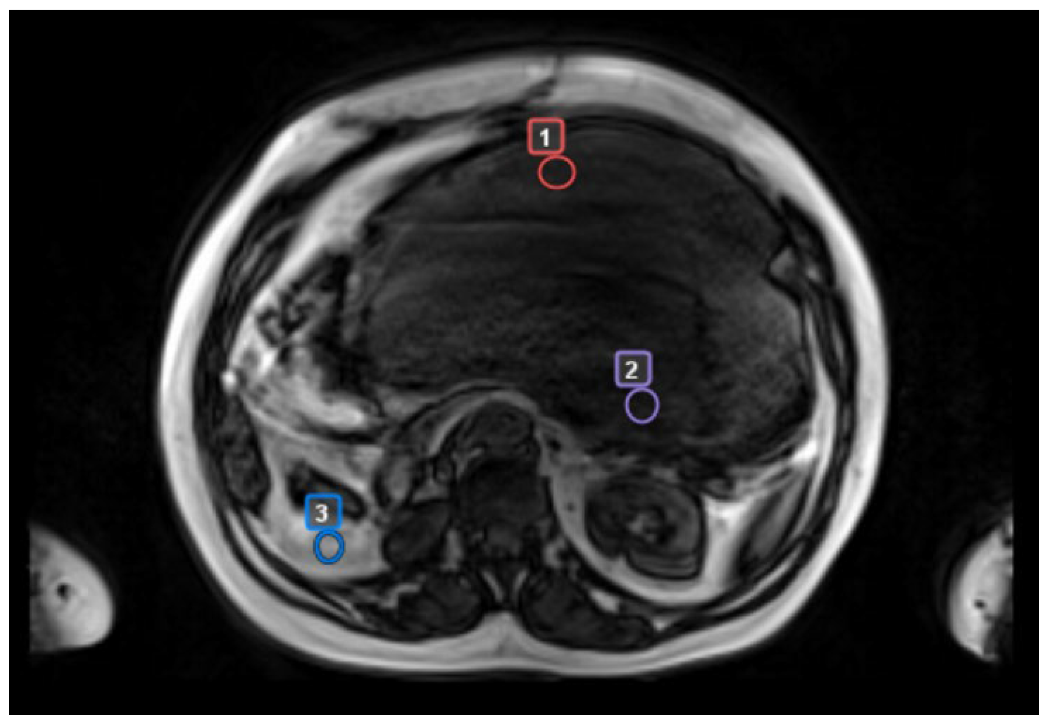 Cancers 17 00976 g002
