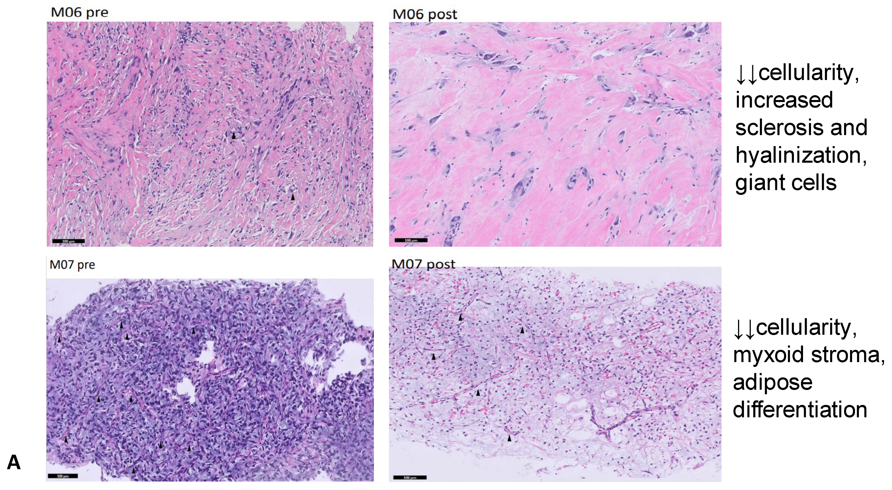 Cancers 17 00976 g004a