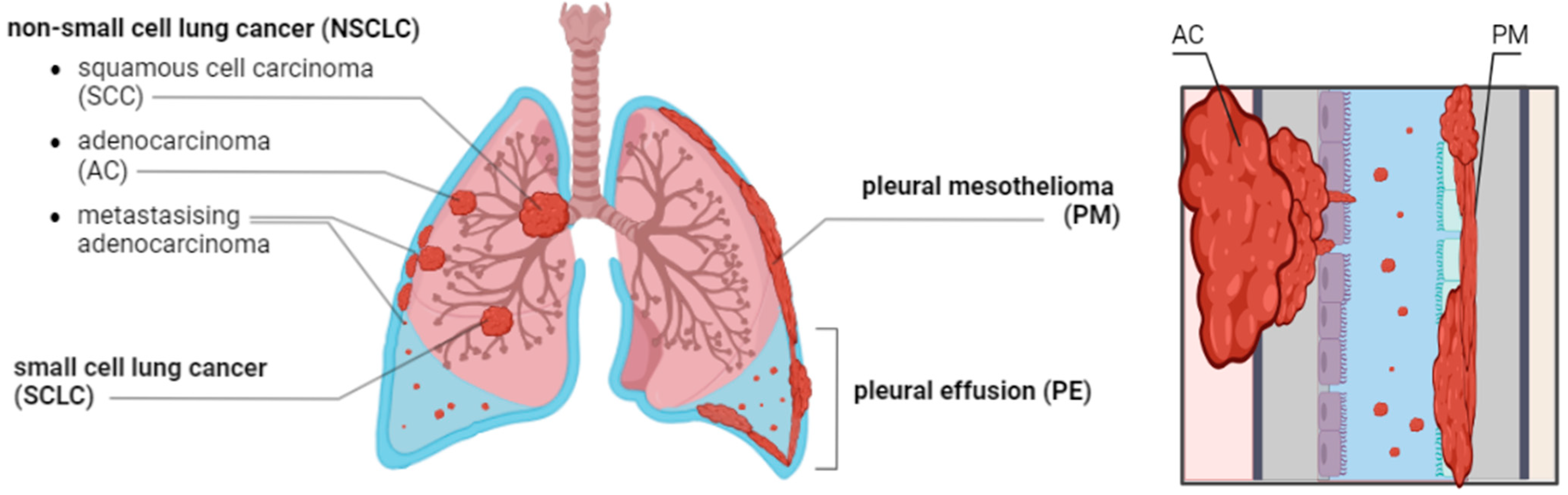 Cancers 17 00986 g001