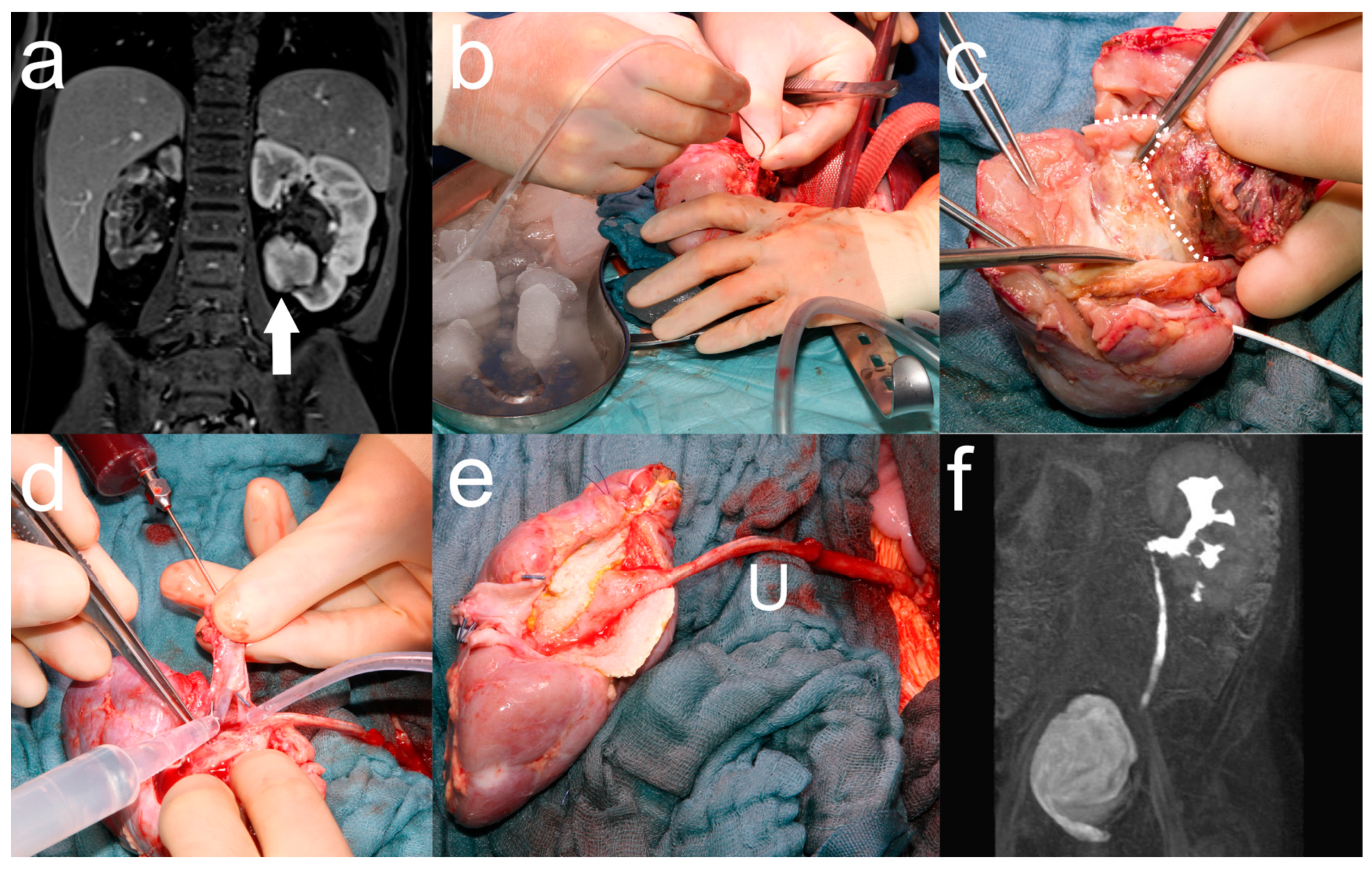 Cancers 17 00989 g001