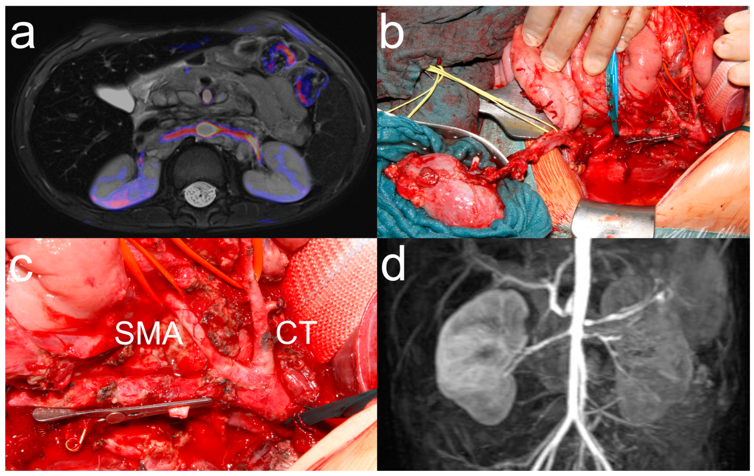 Cancers 17 00989 g002