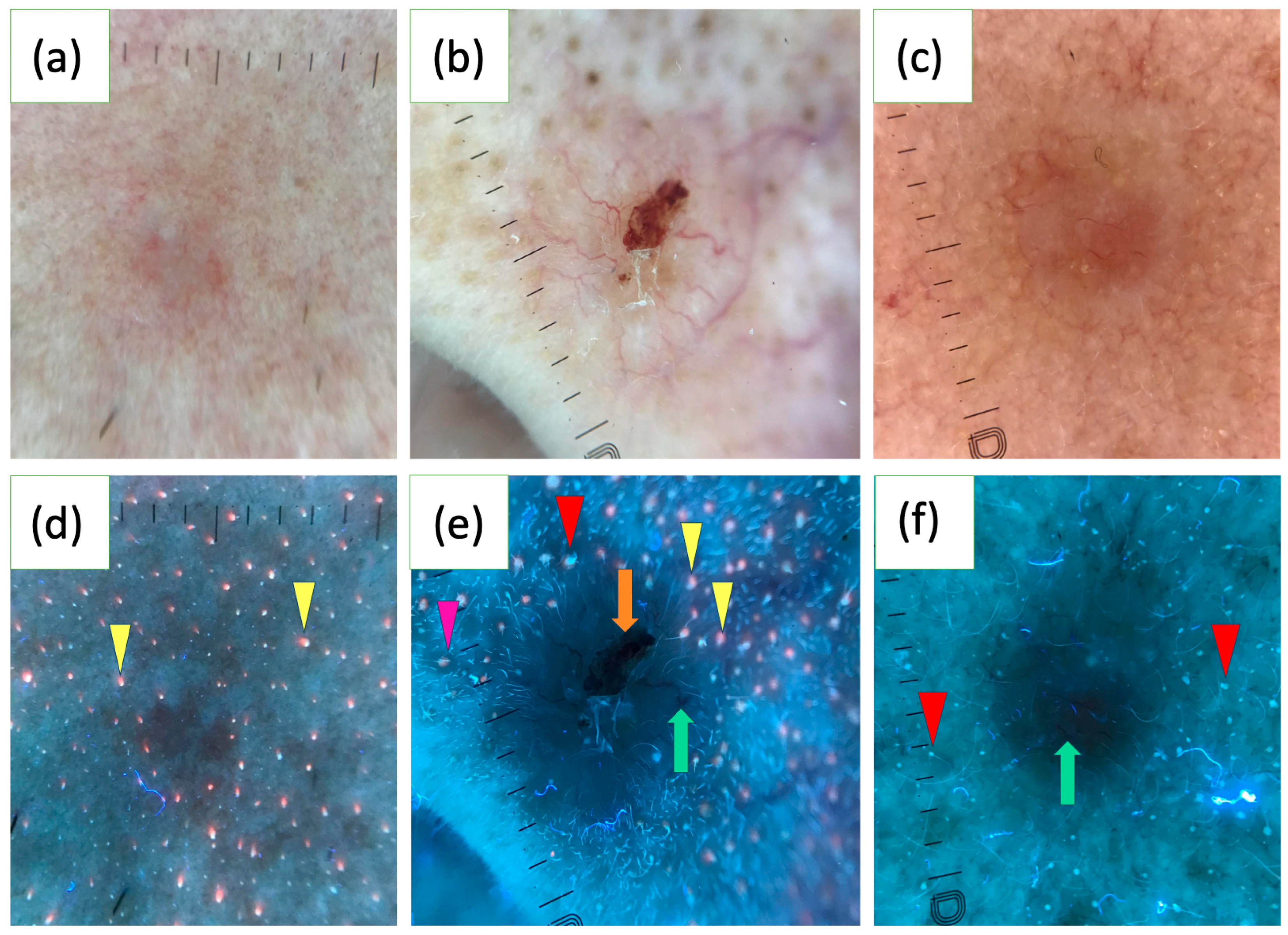 Cancers 17 01025 g002