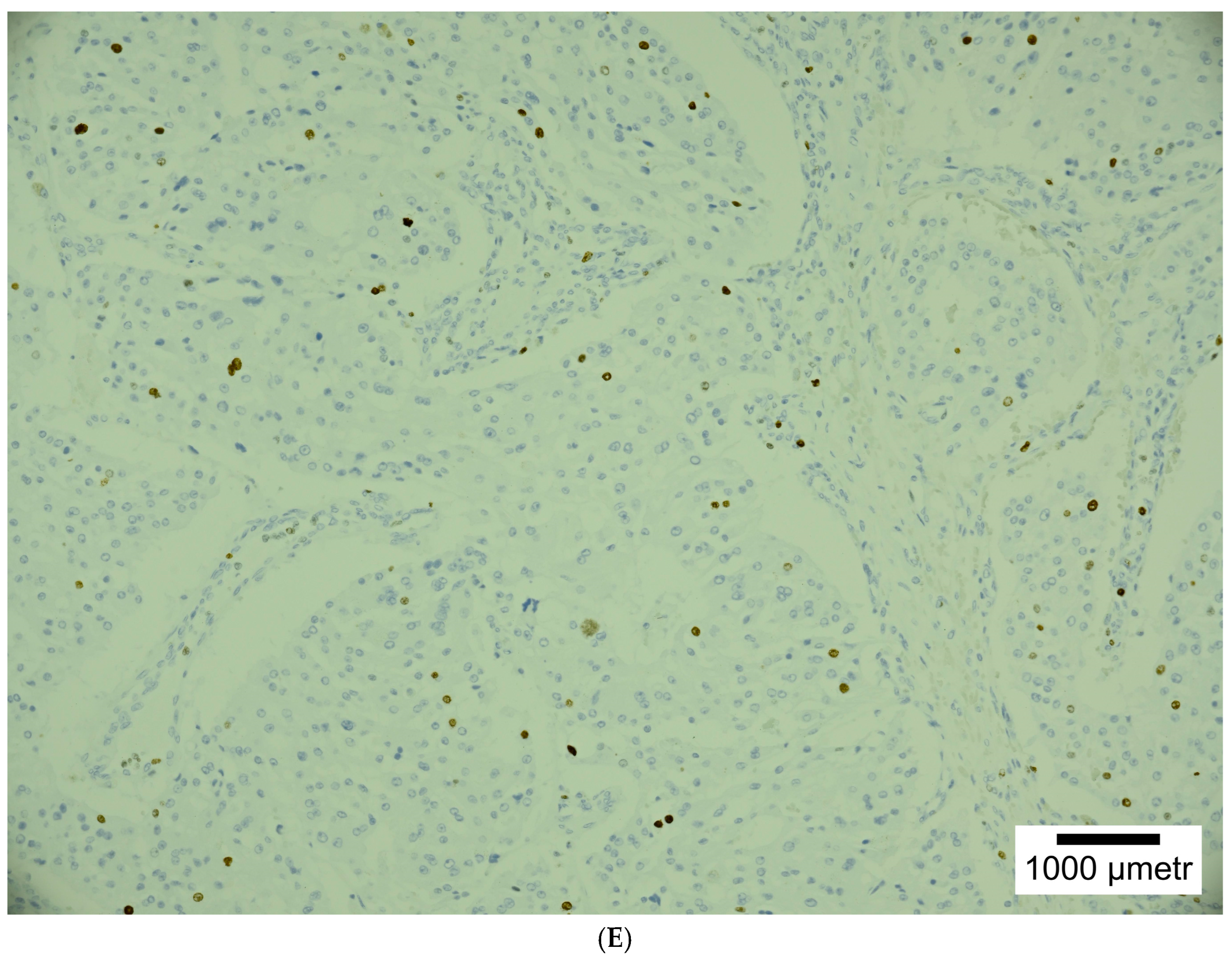 Cancers 17 01029 g002c