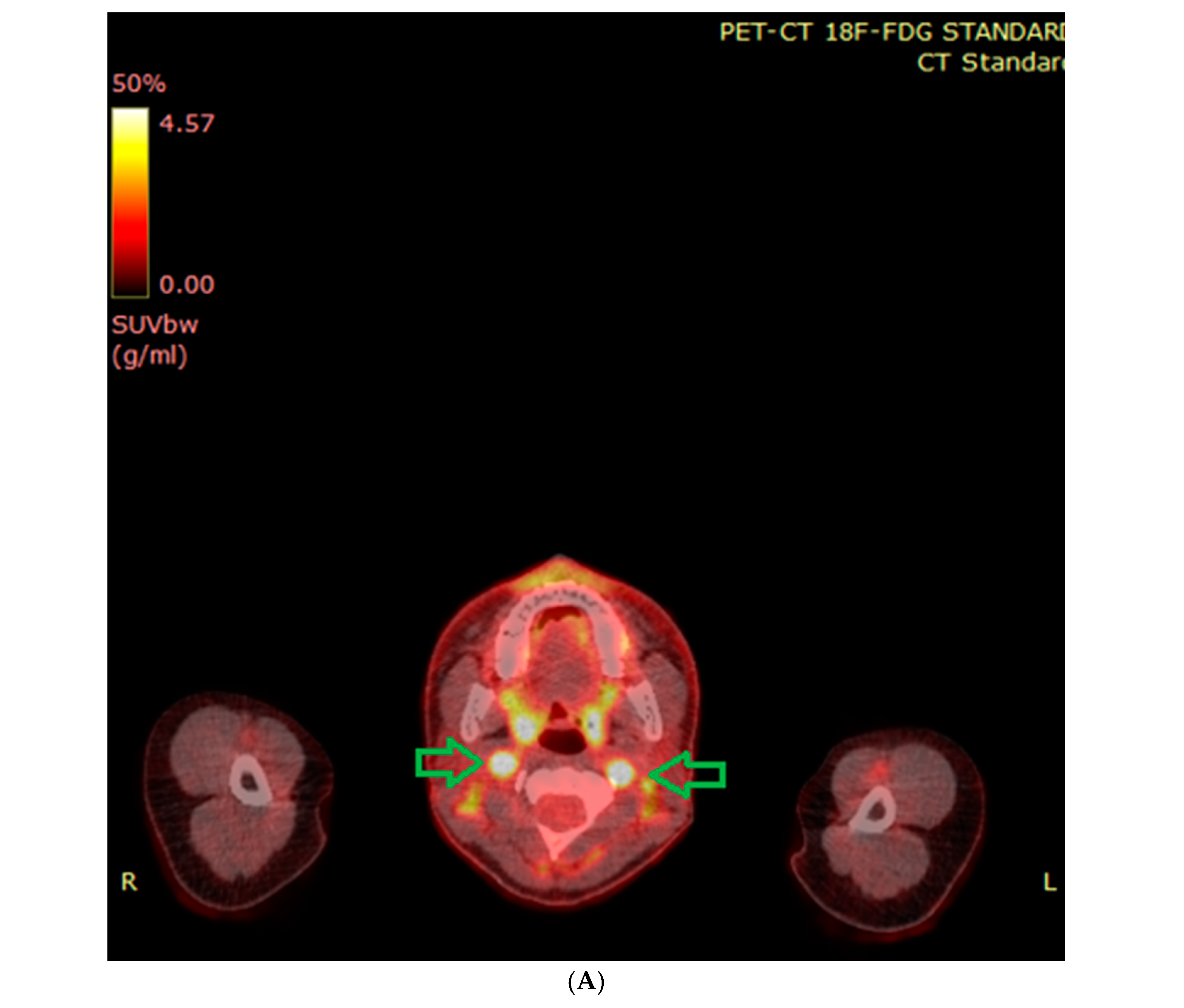 Cancers 17 01029 g003a
