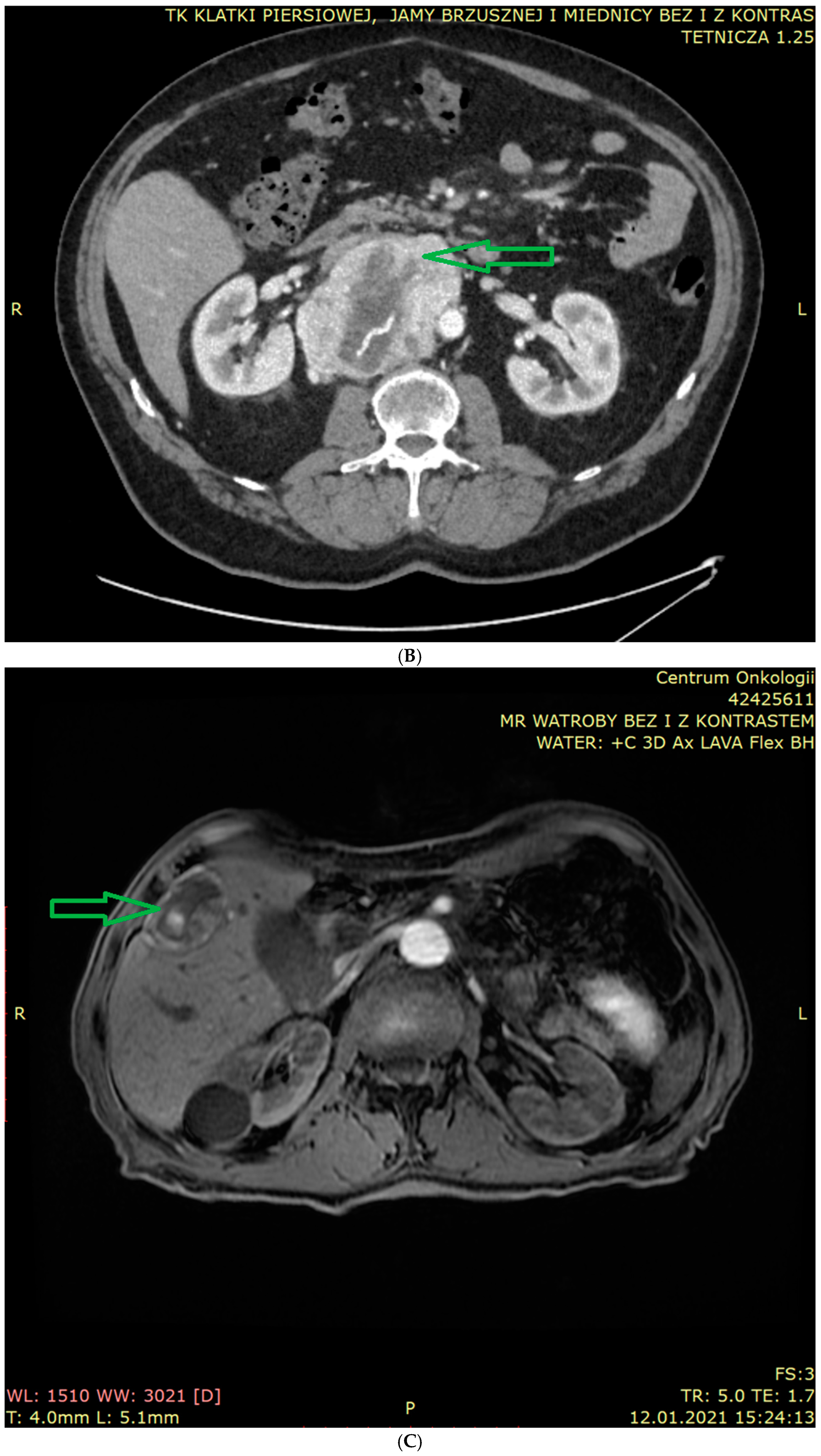 Cancers 17 01029 g003b