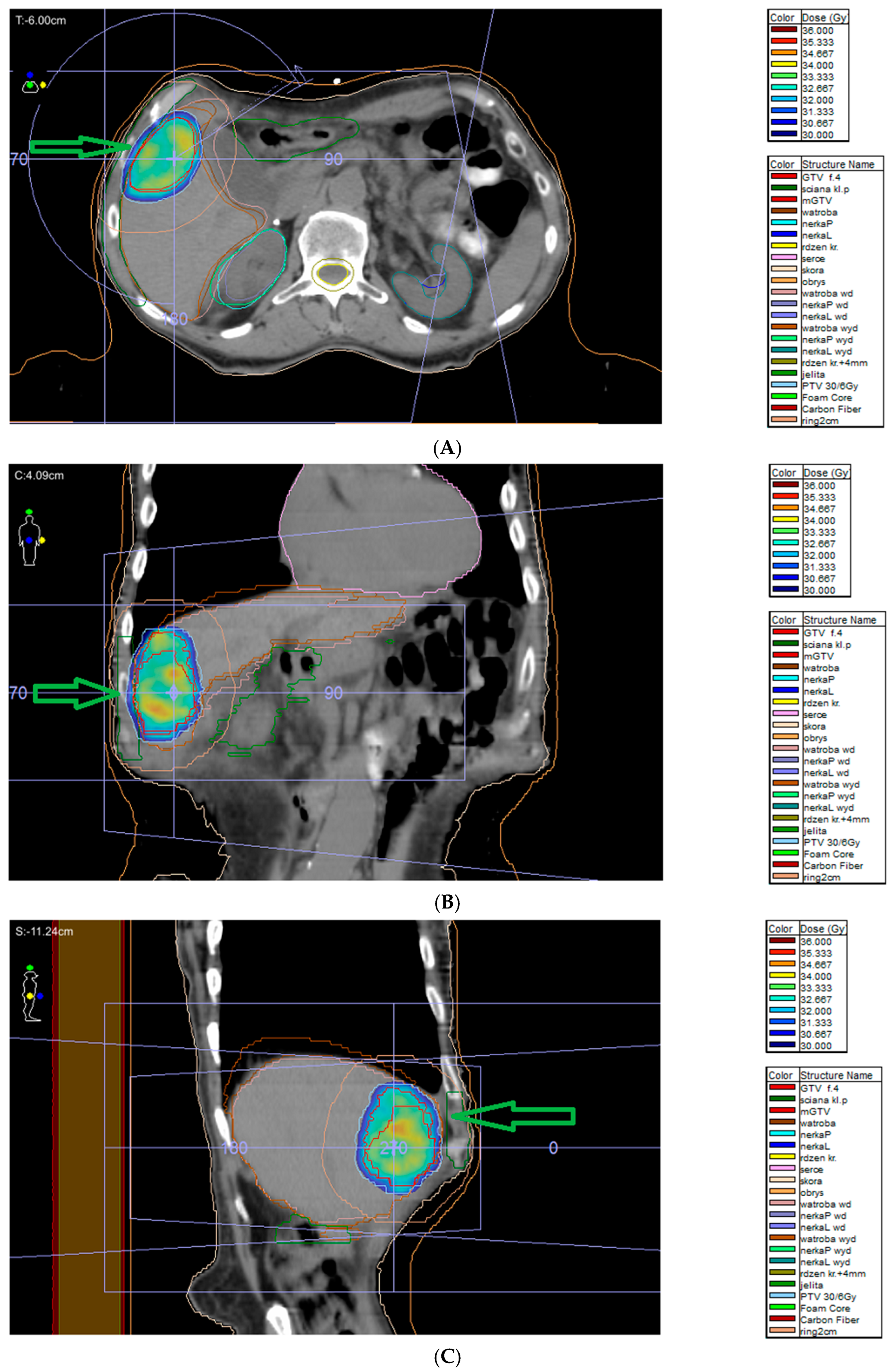 Cancers 17 01029 g005