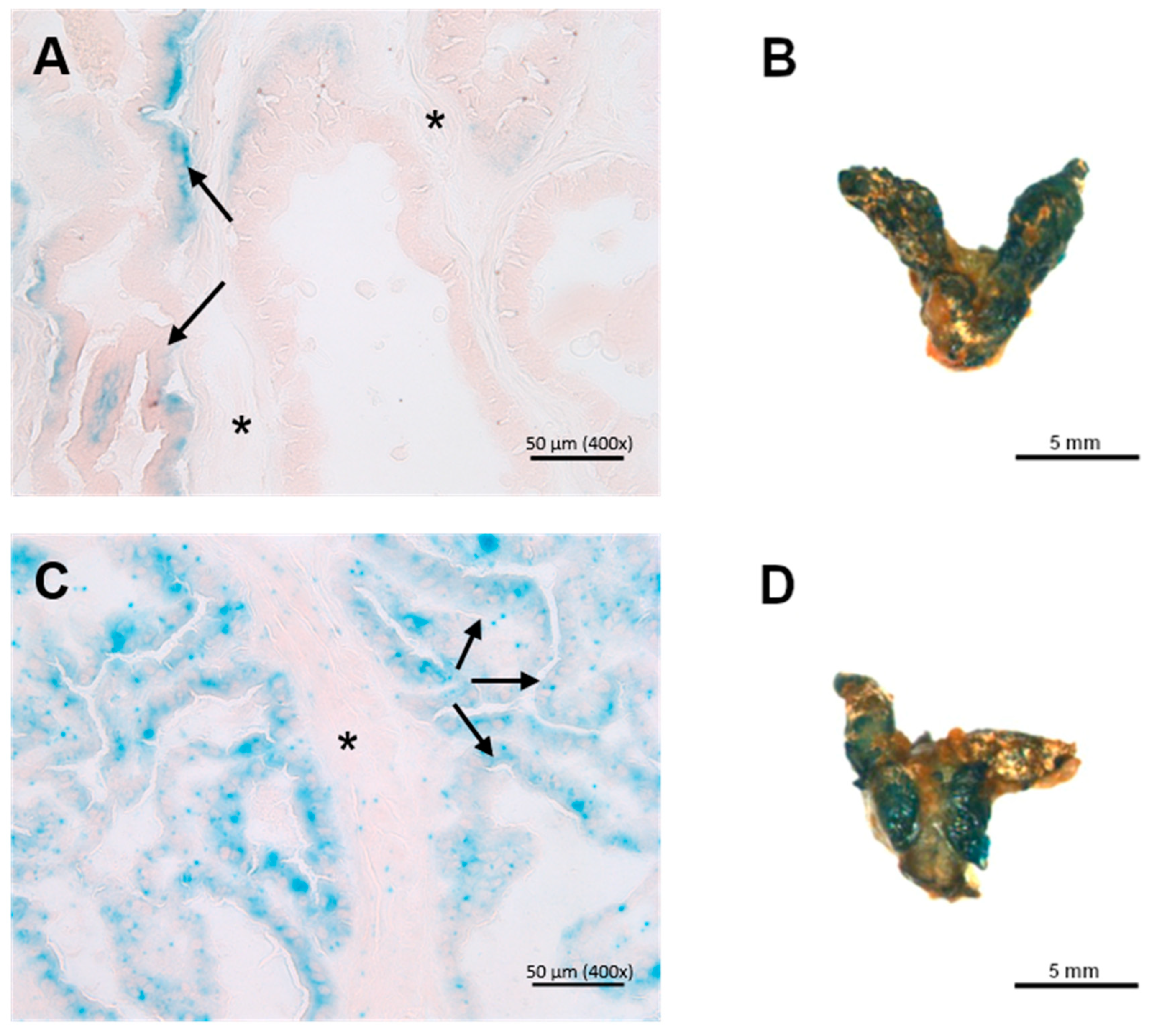 Cancers 17 01037 g004