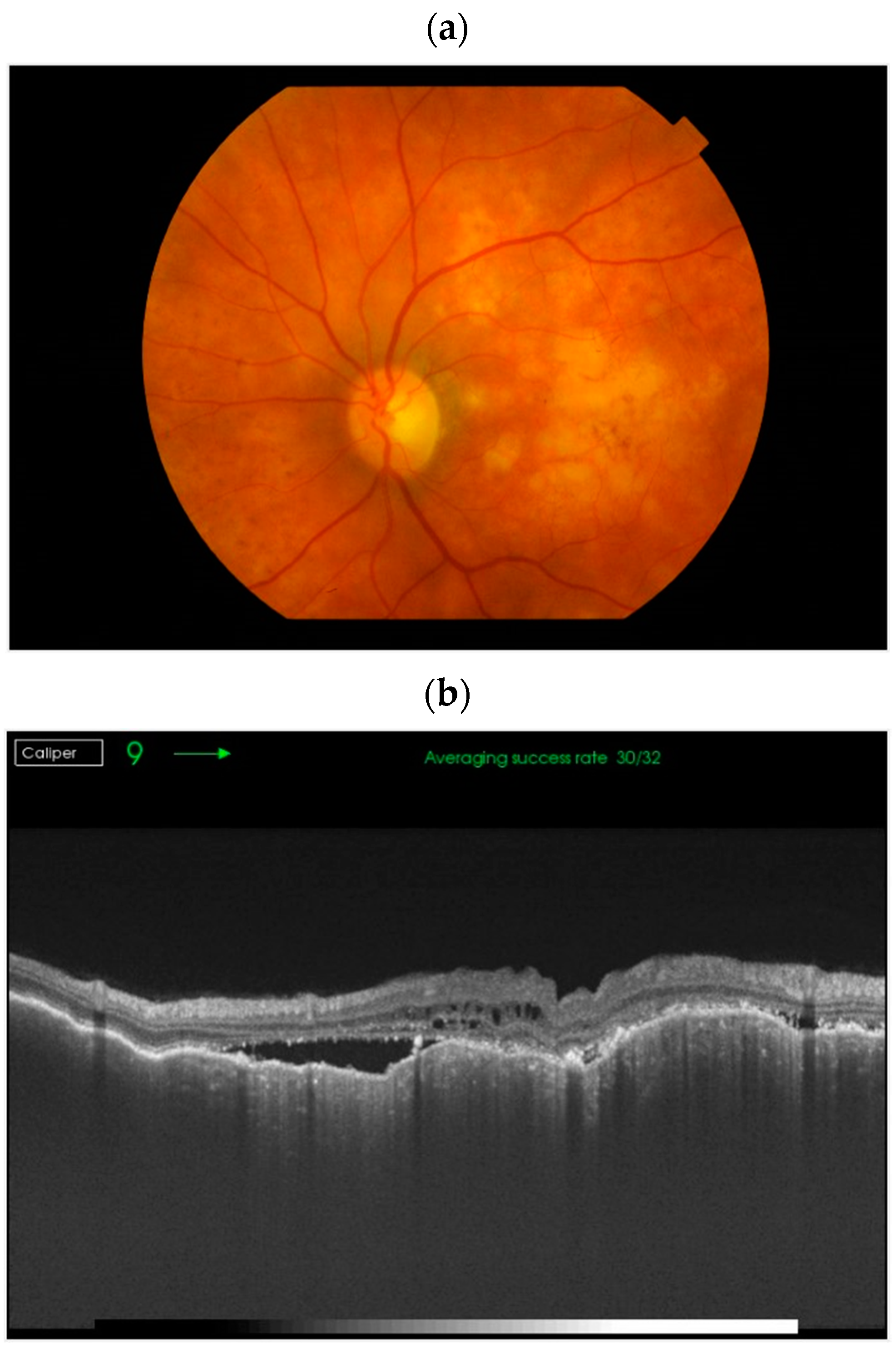 Cancers 17 01041 g001