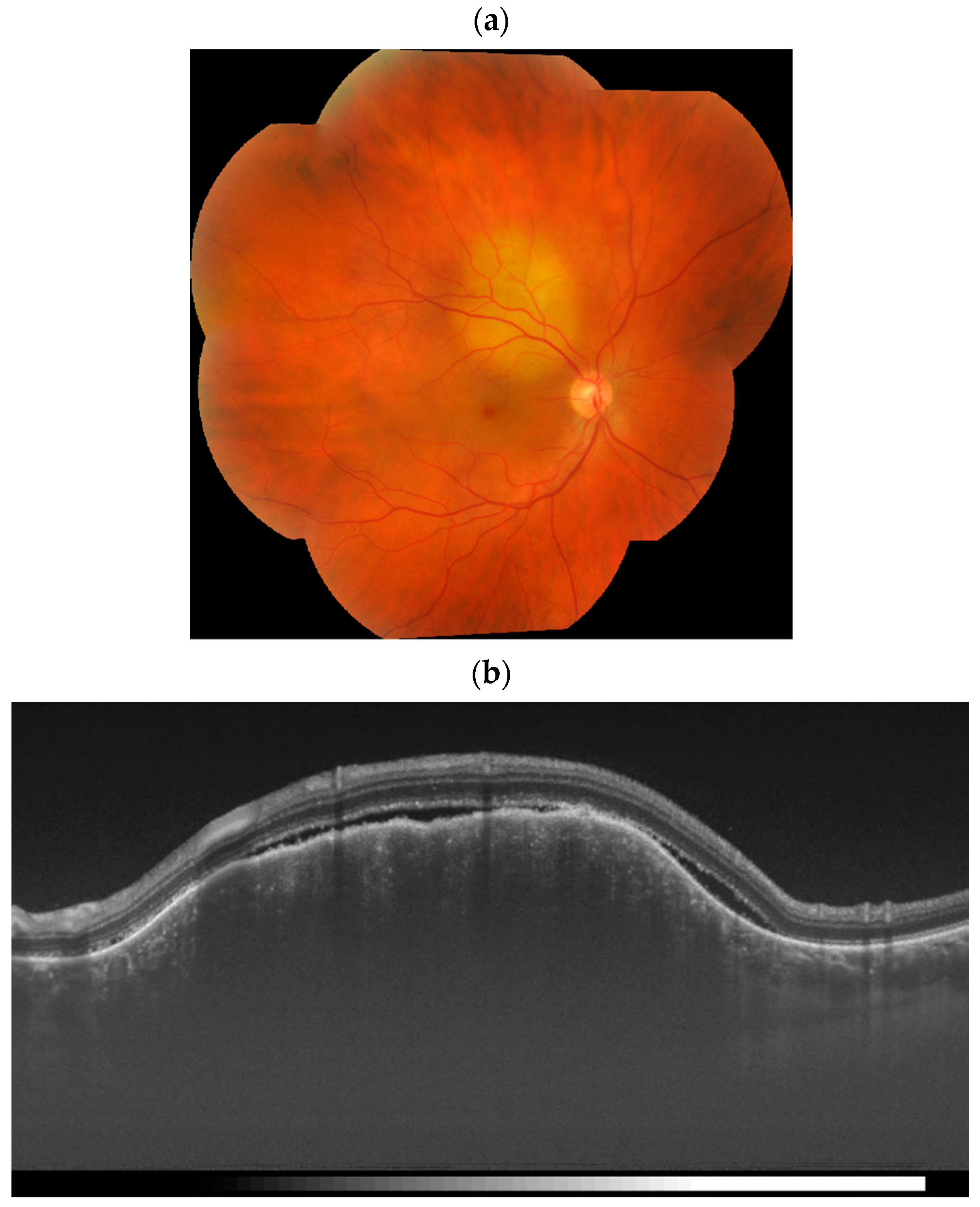 Cancers 17 01041 g002