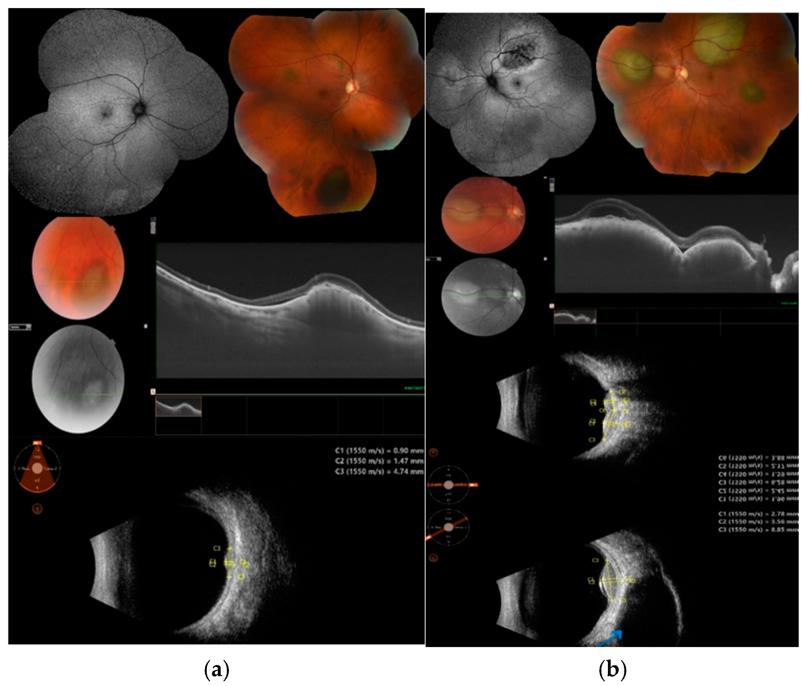 Cancers 17 01041 g003