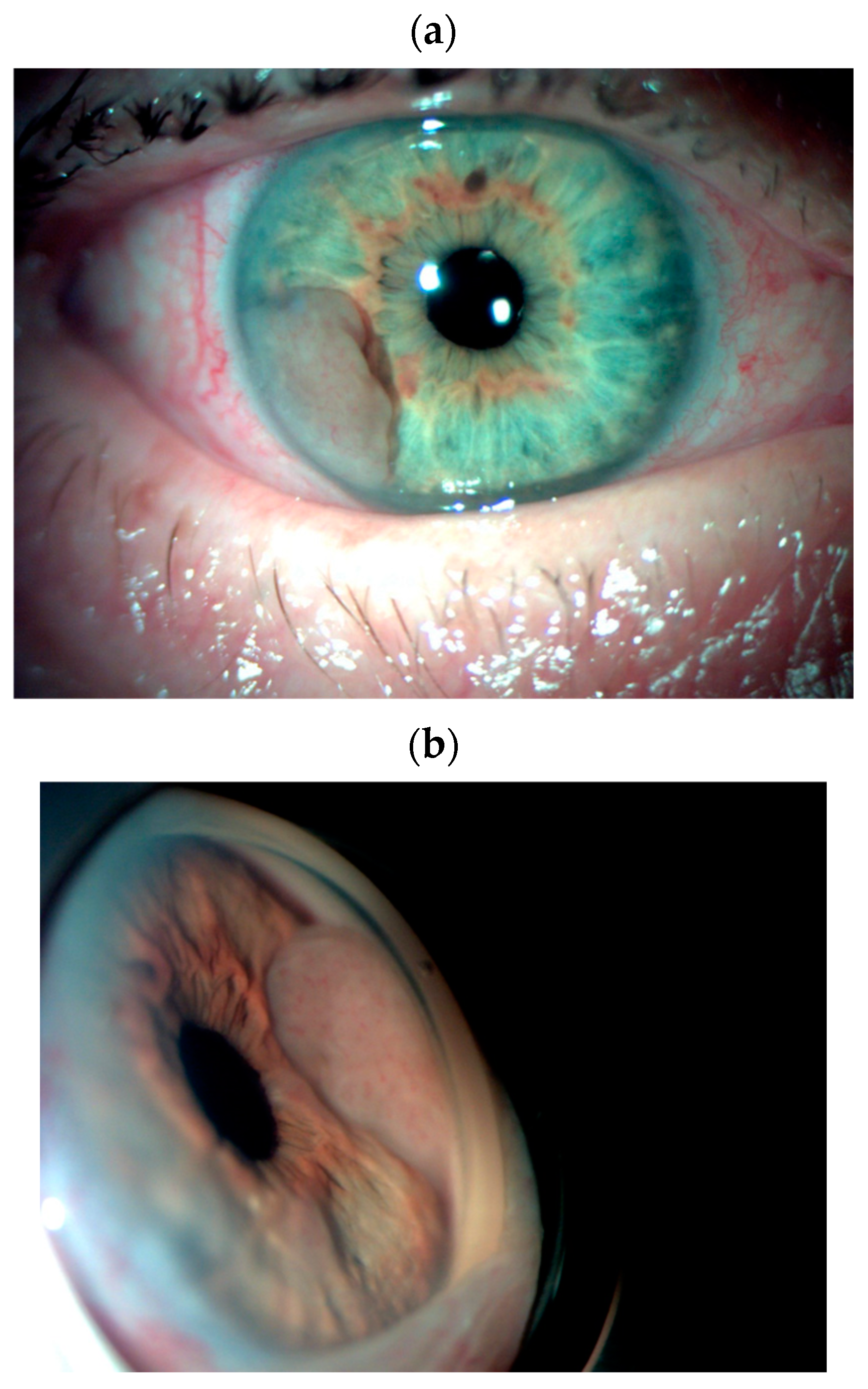 Cancers 17 01041 g004a