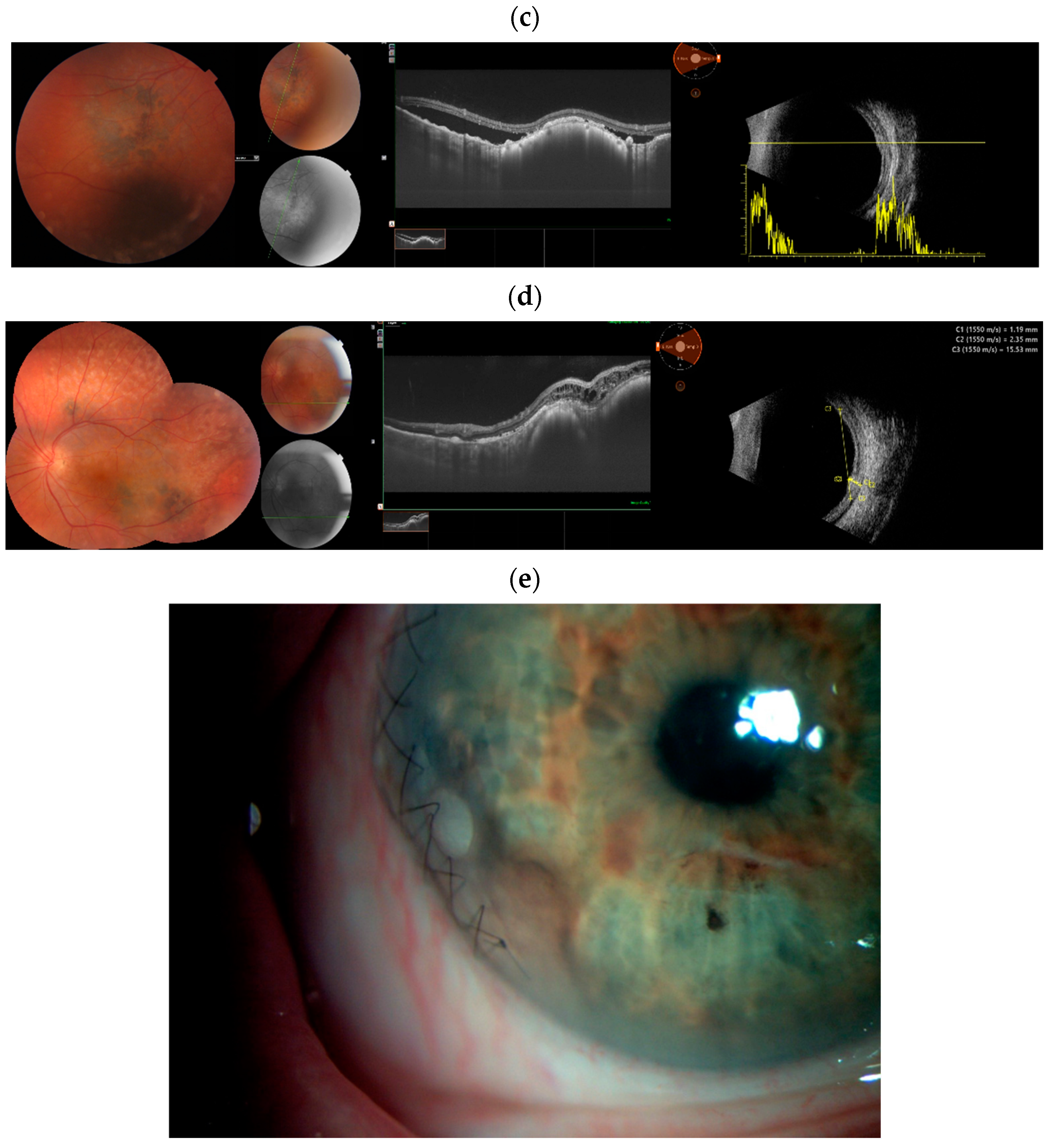Cancers 17 01041 g004b