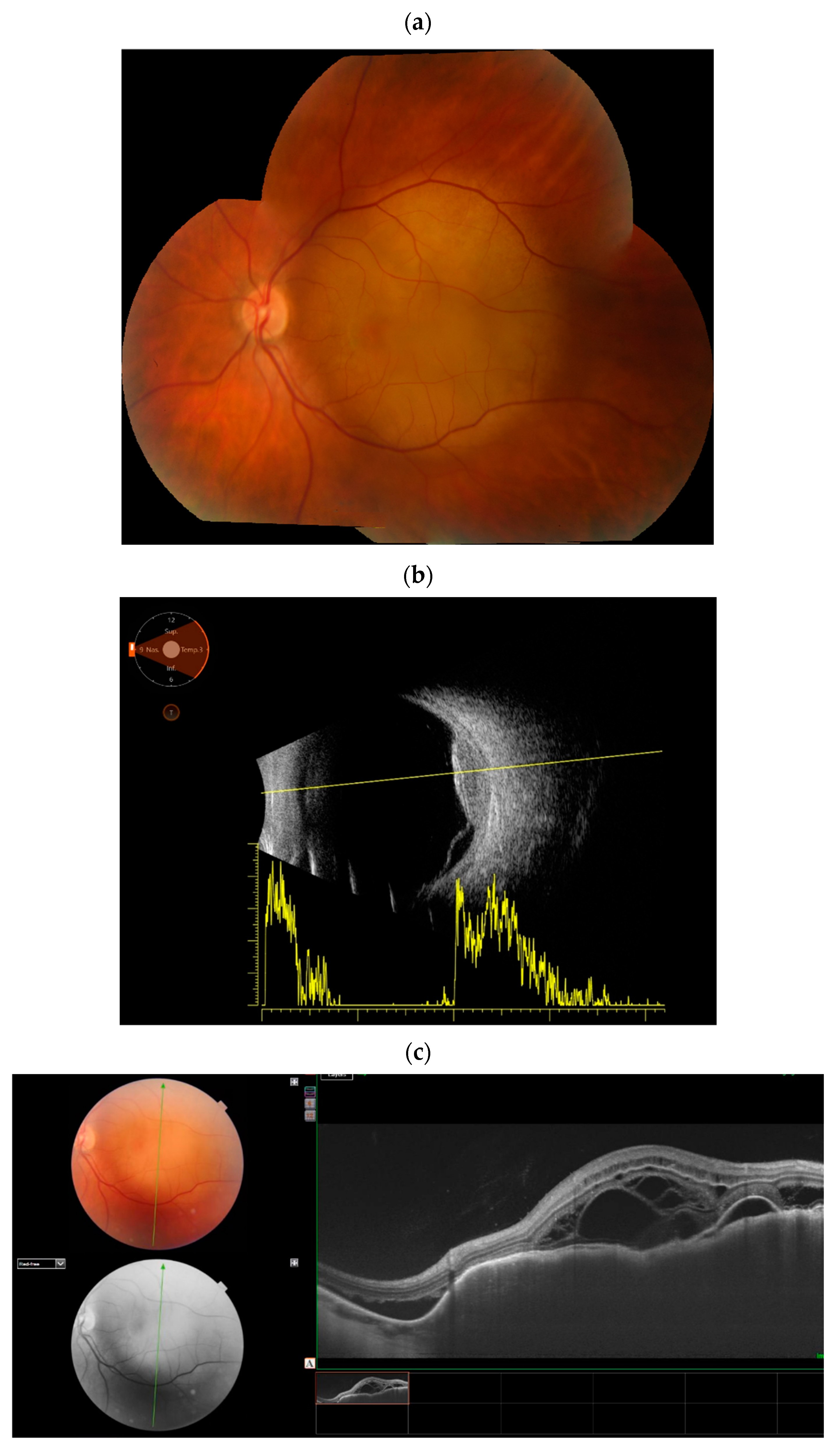 Cancers 17 01041 g005