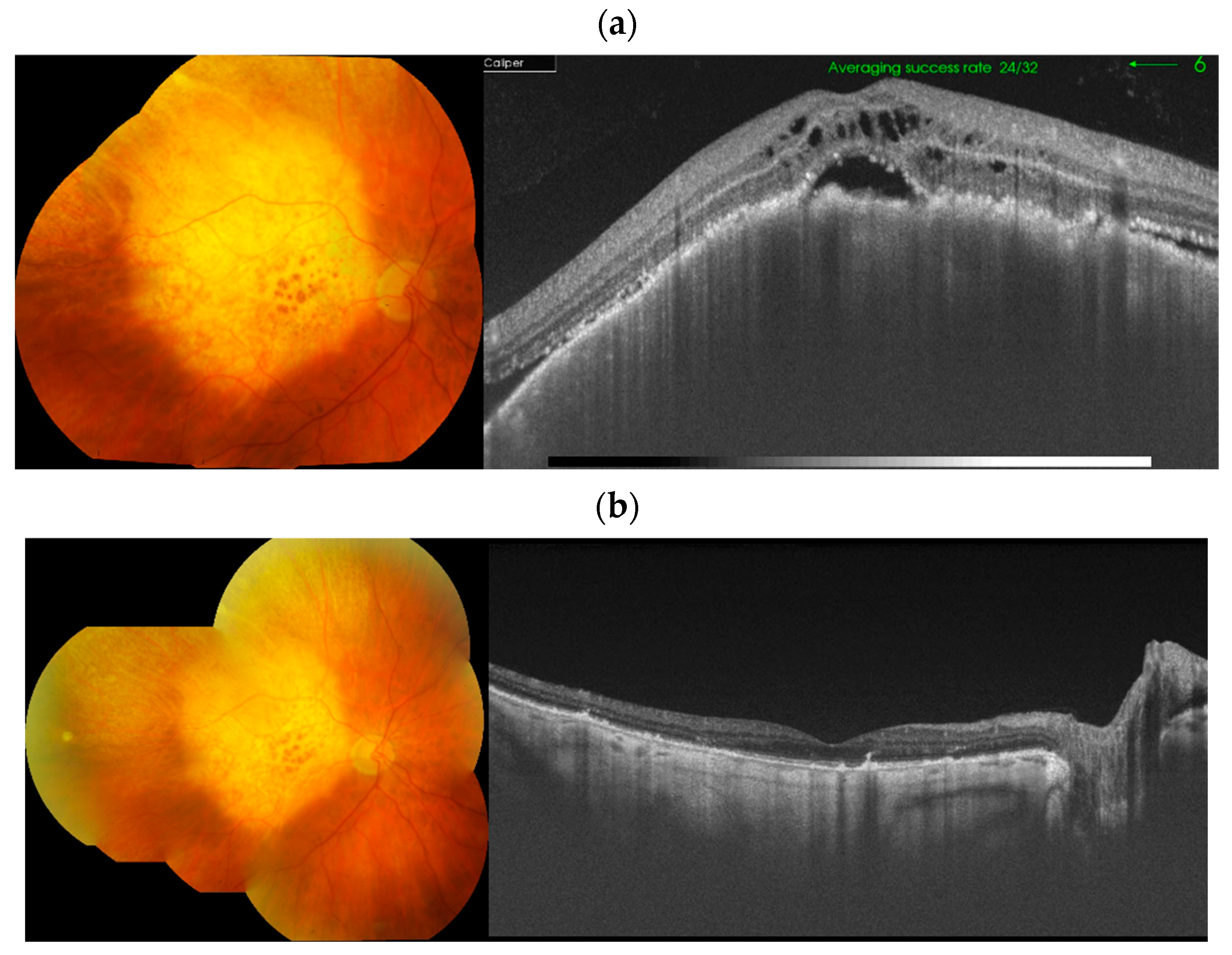 Cancers 17 01041 g006