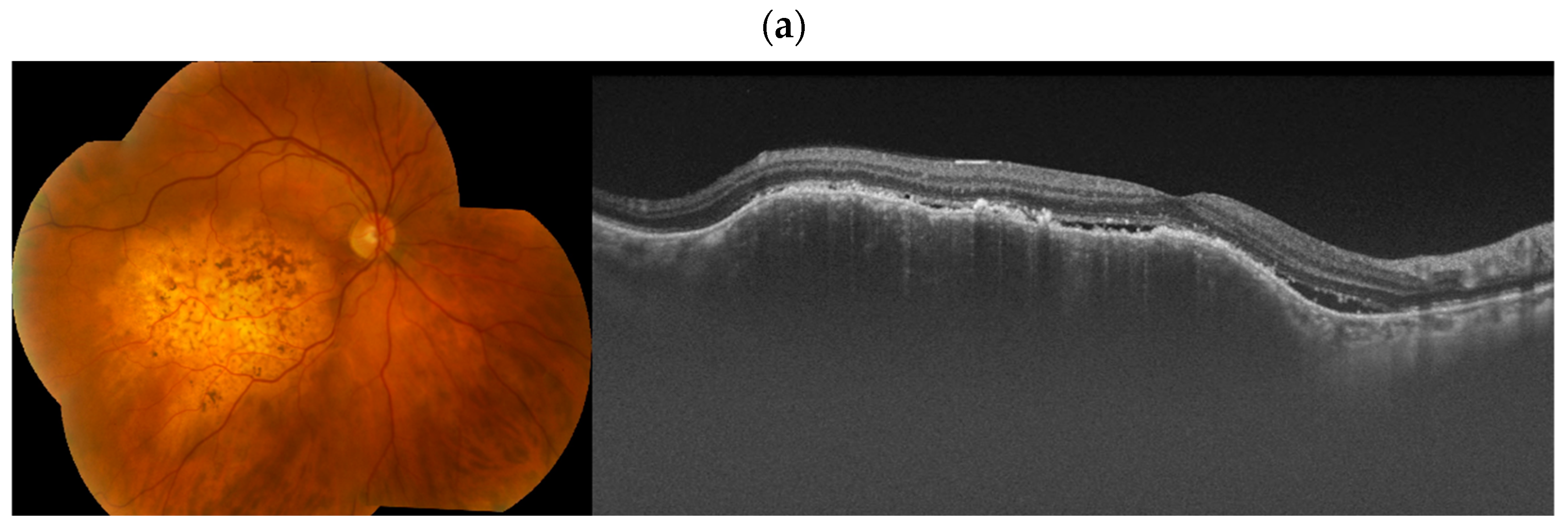 Cancers 17 01041 g008a