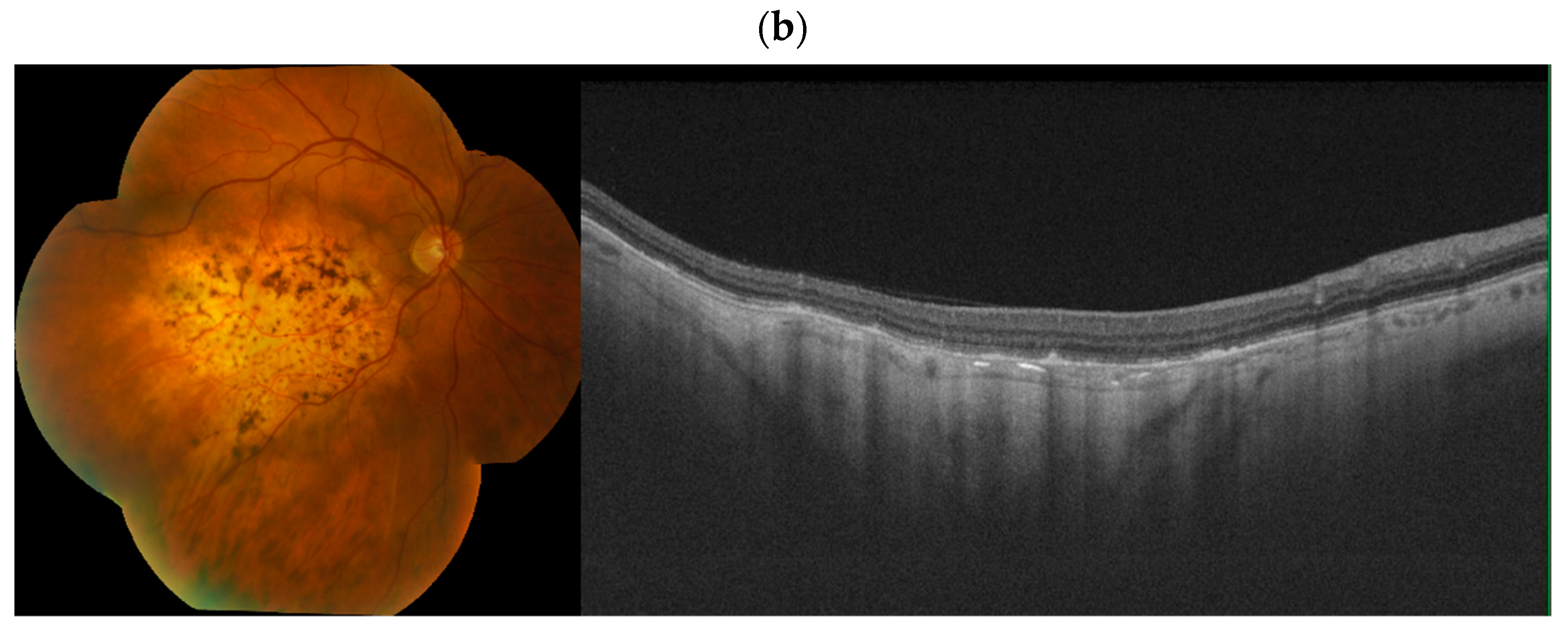 Cancers 17 01041 g008b