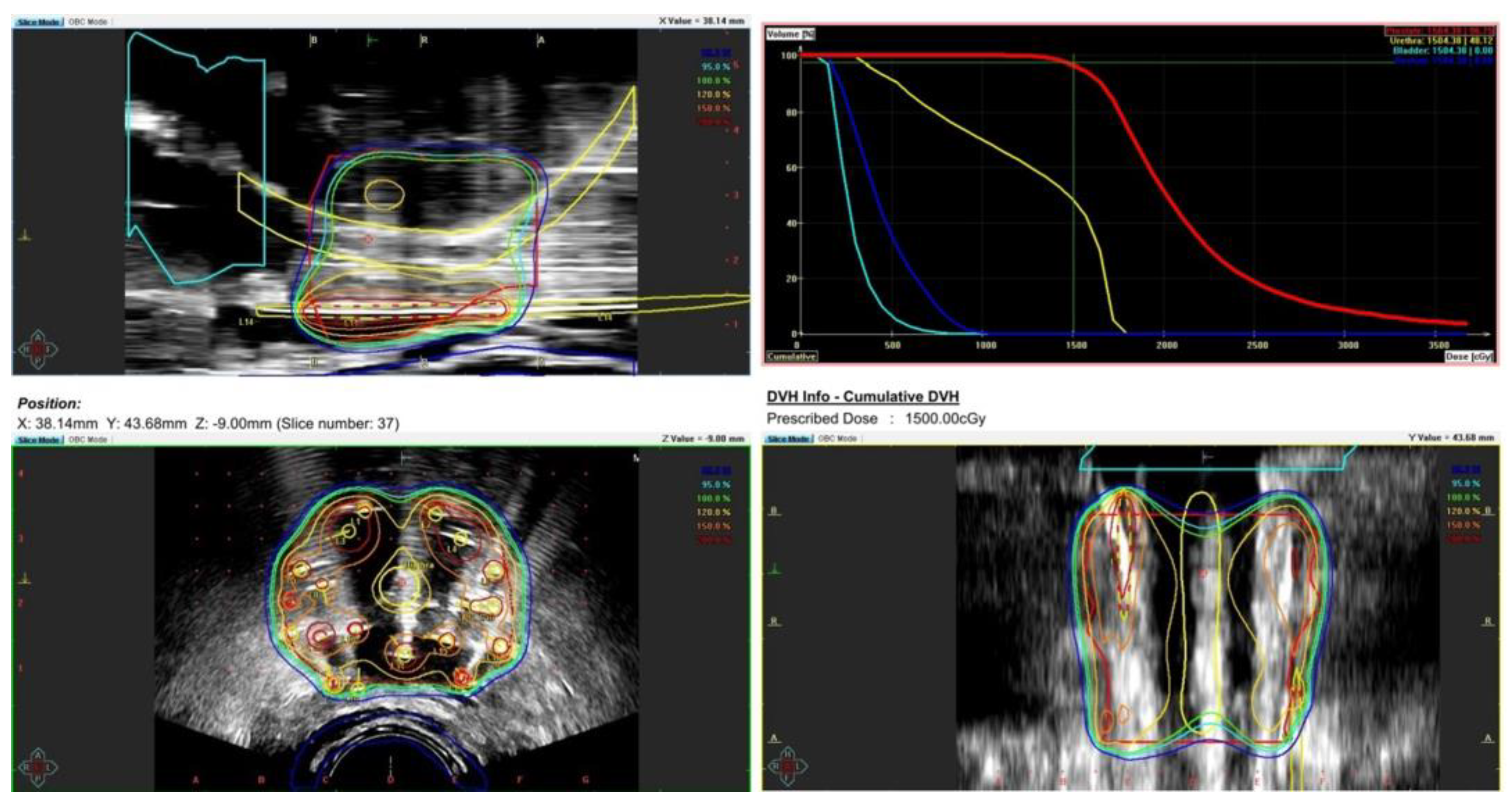 Cancers 17 01045 g003