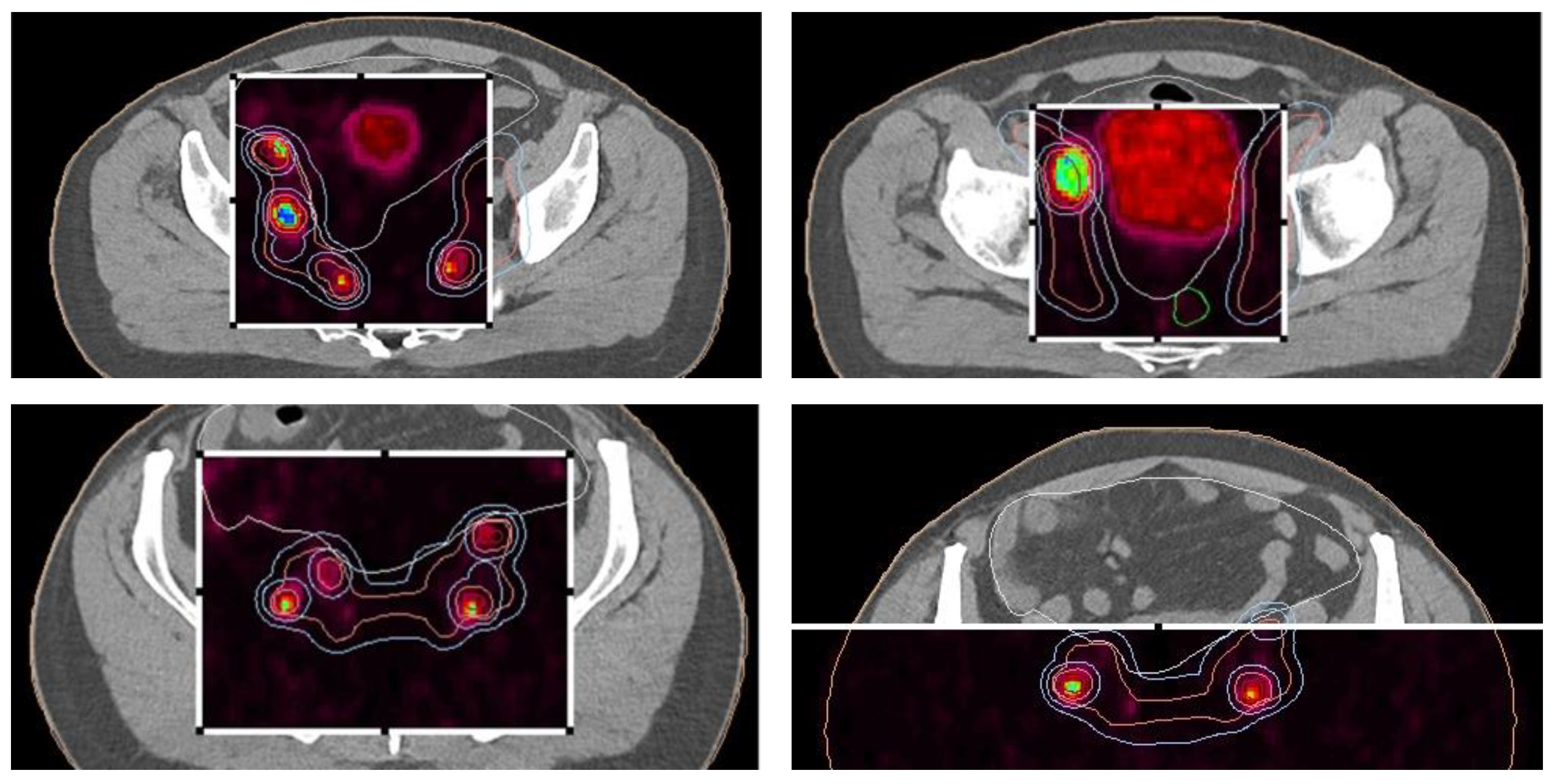 Cancers 17 01045 g004