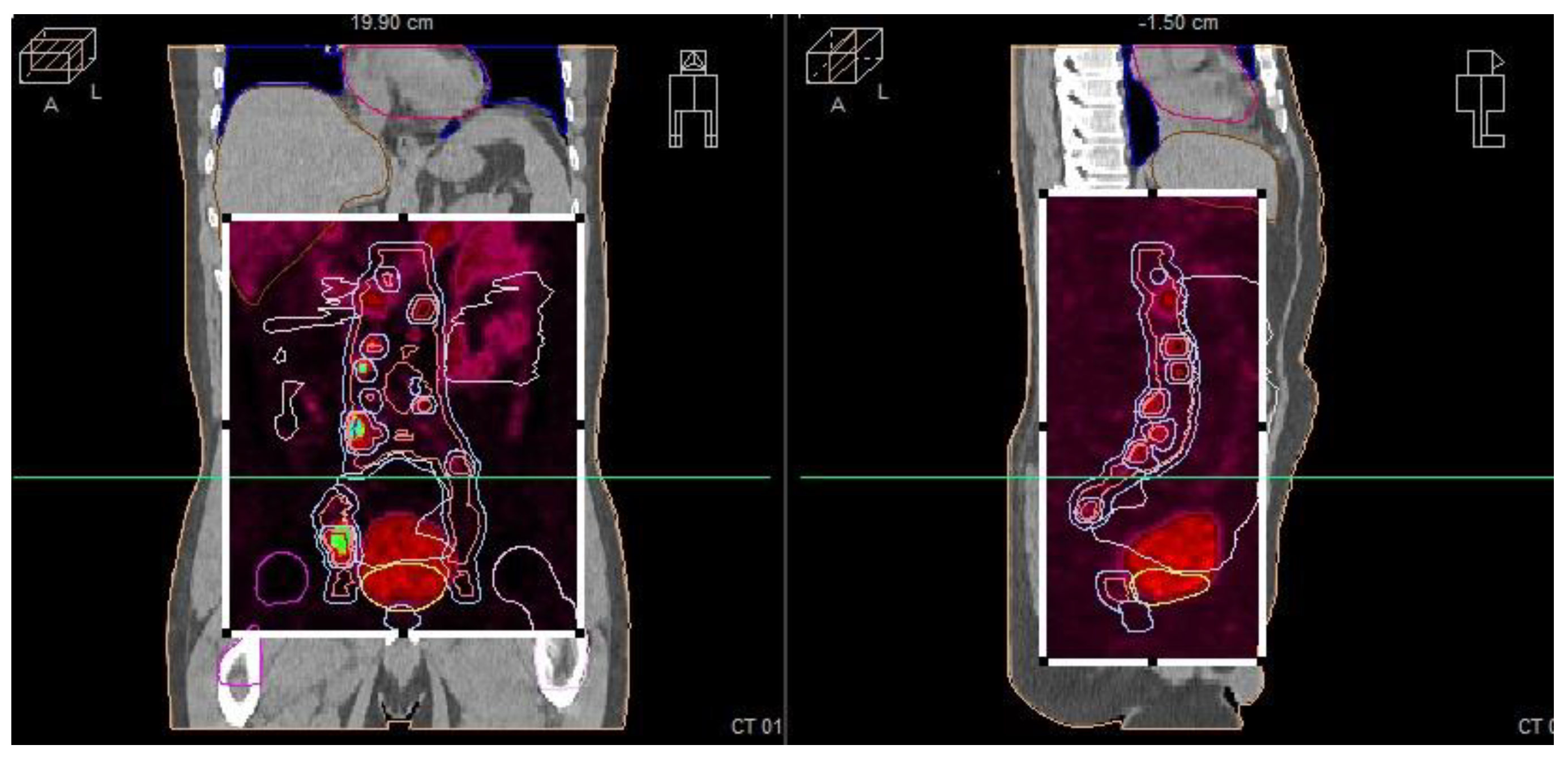 Cancers 17 01045 g005