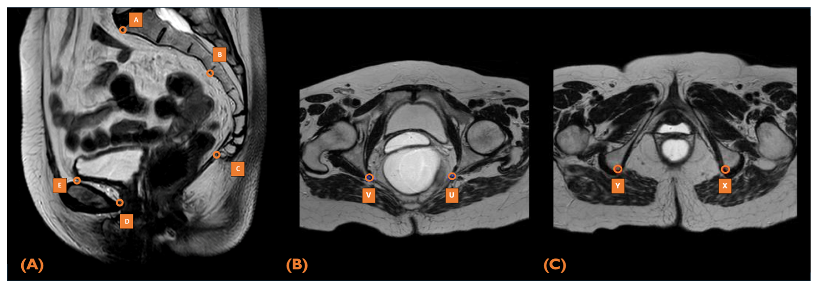 Cancers 17 01051 g001