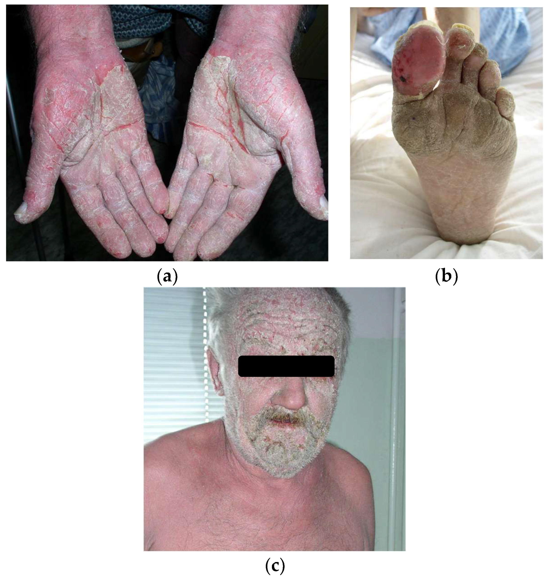 Cancers 17 01053 g002