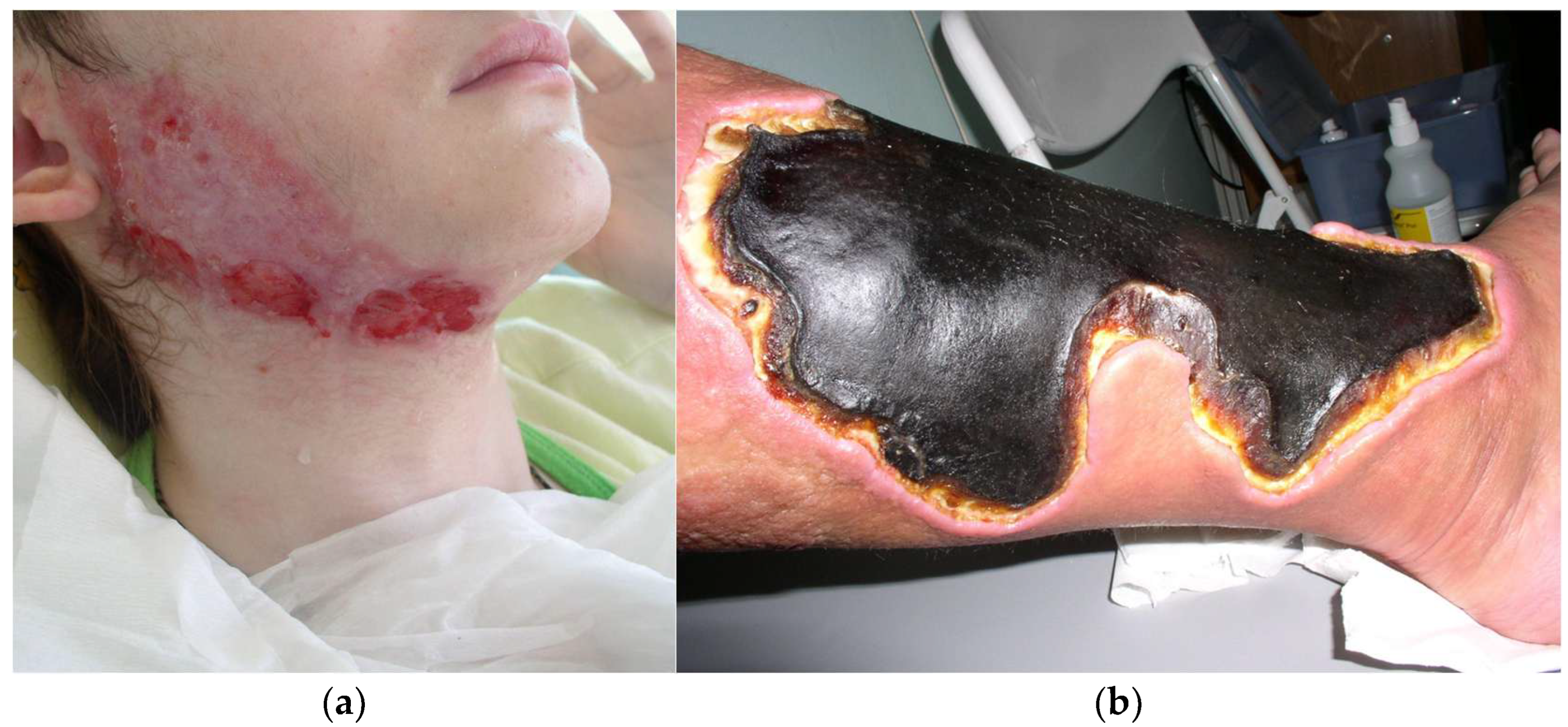 Cancers 17 01053 g003