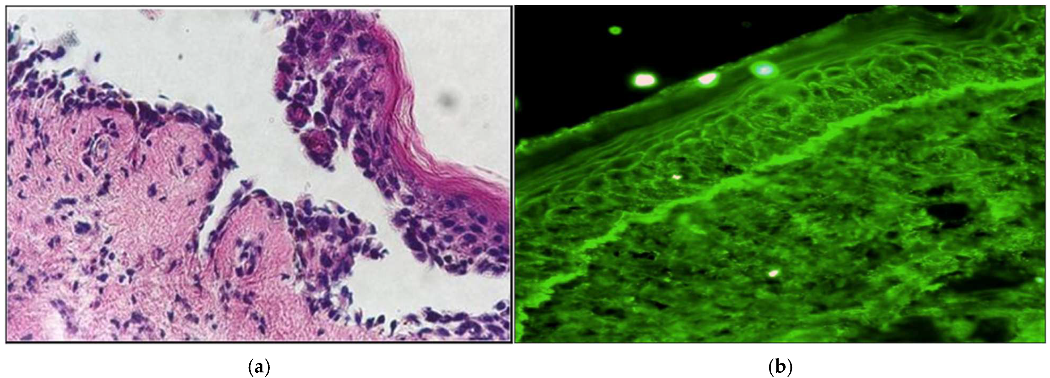 Cancers 17 01053 g005