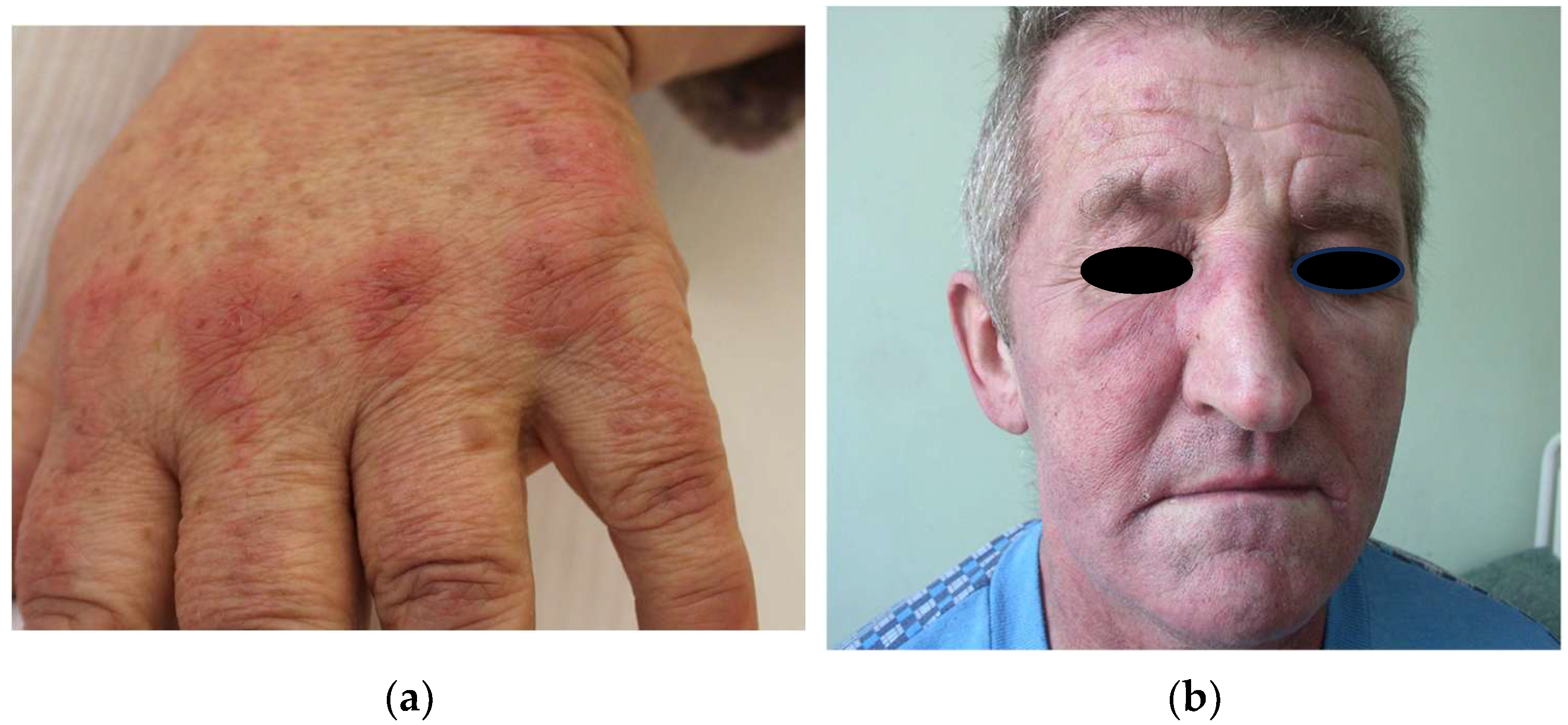 Cancers 17 01053 g006