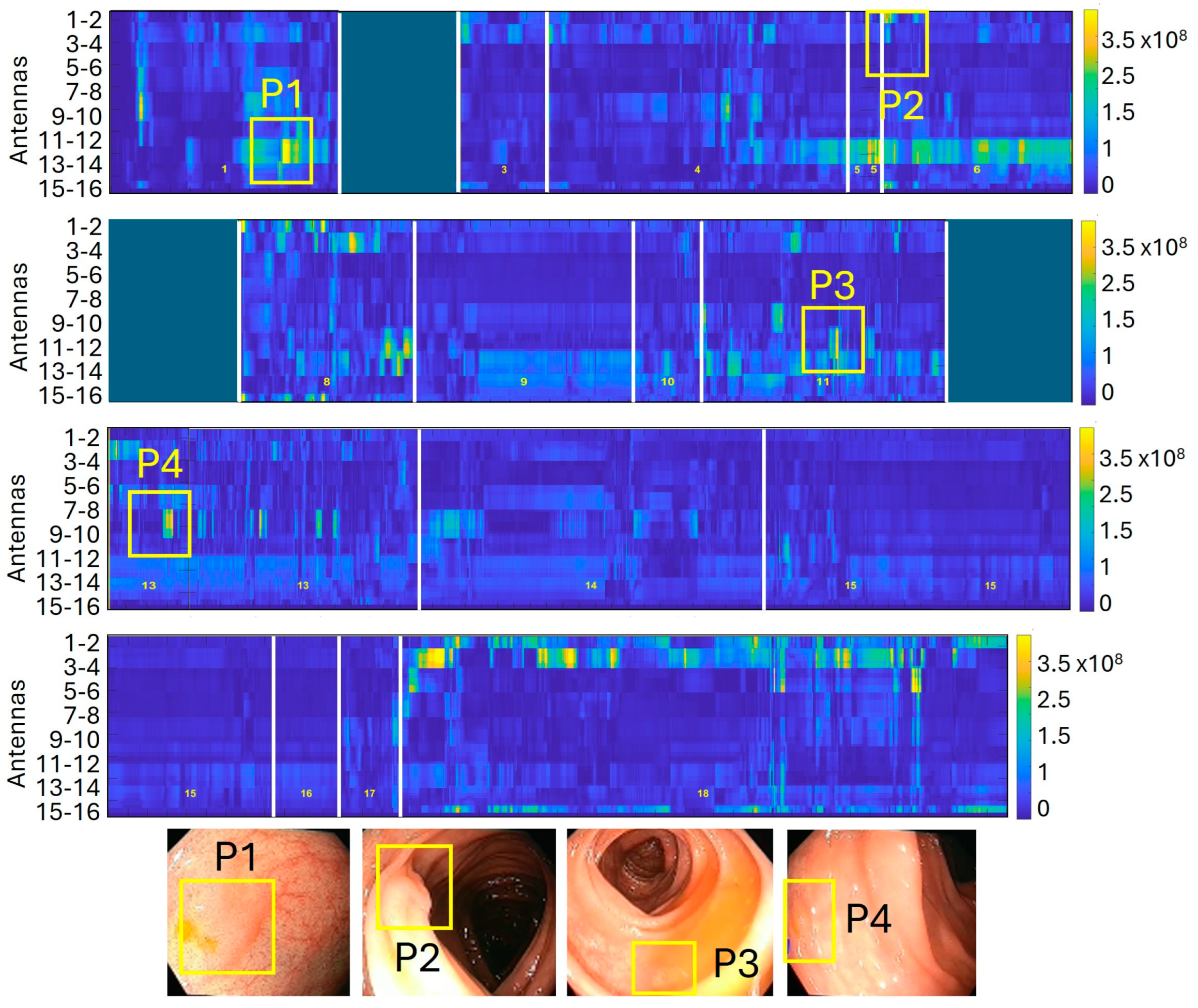 Cancers 17 01073 g004
