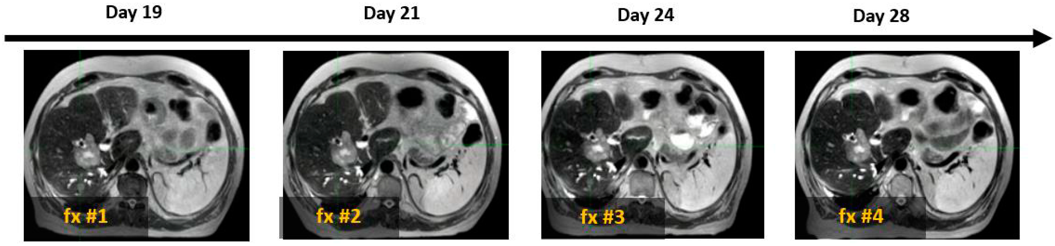Cancers 17 01088 g004