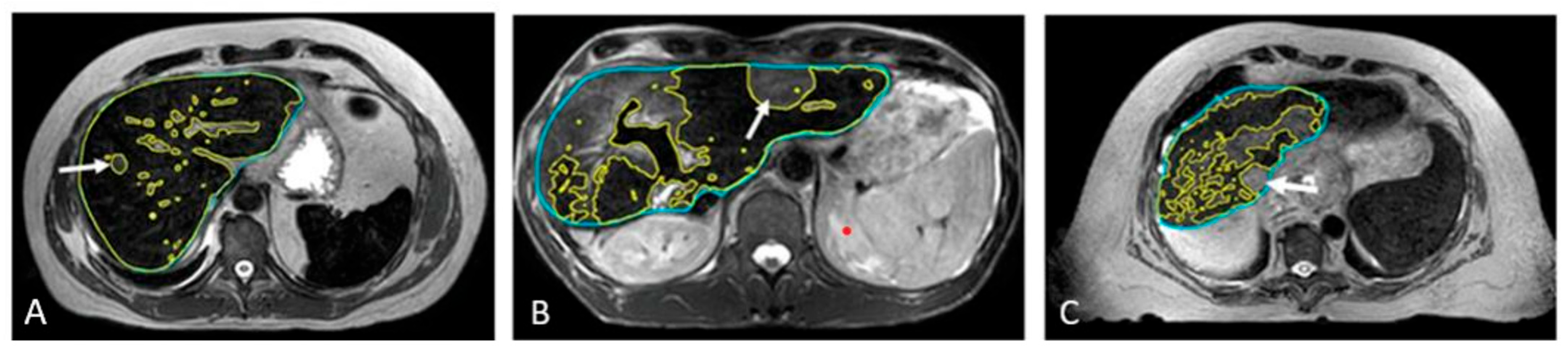 Cancers 17 01088 g006