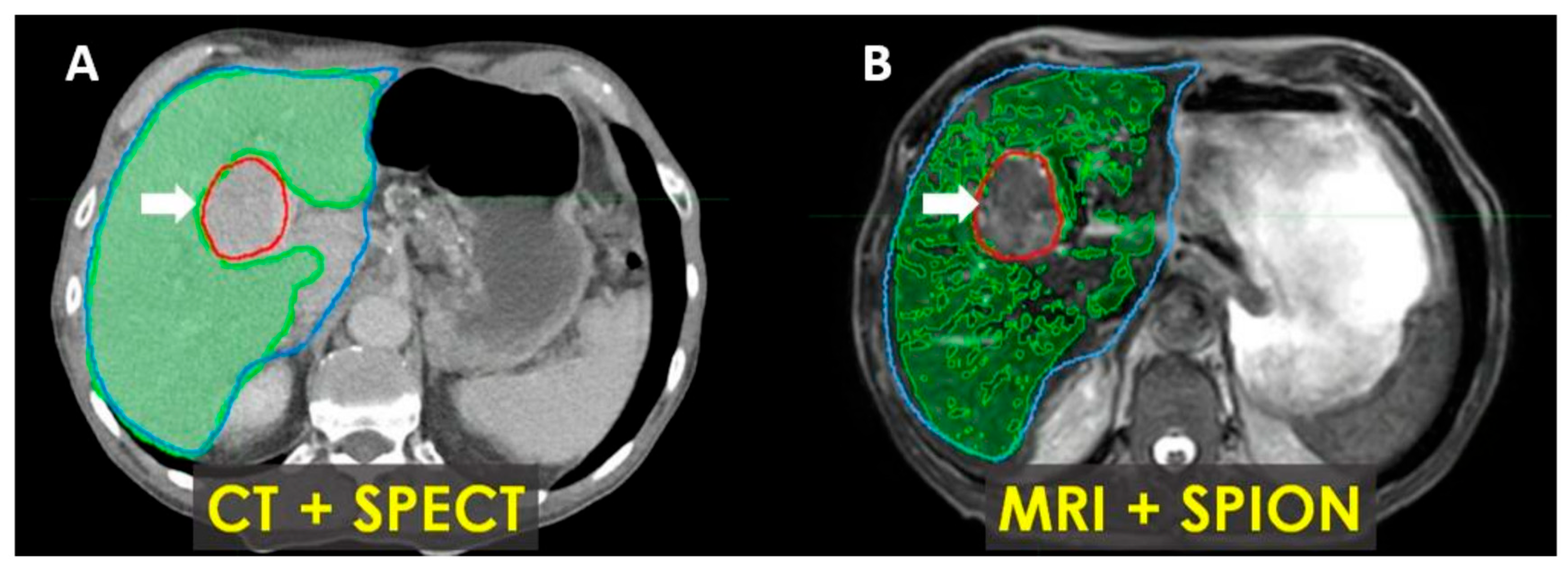 Cancers 17 01088 g007