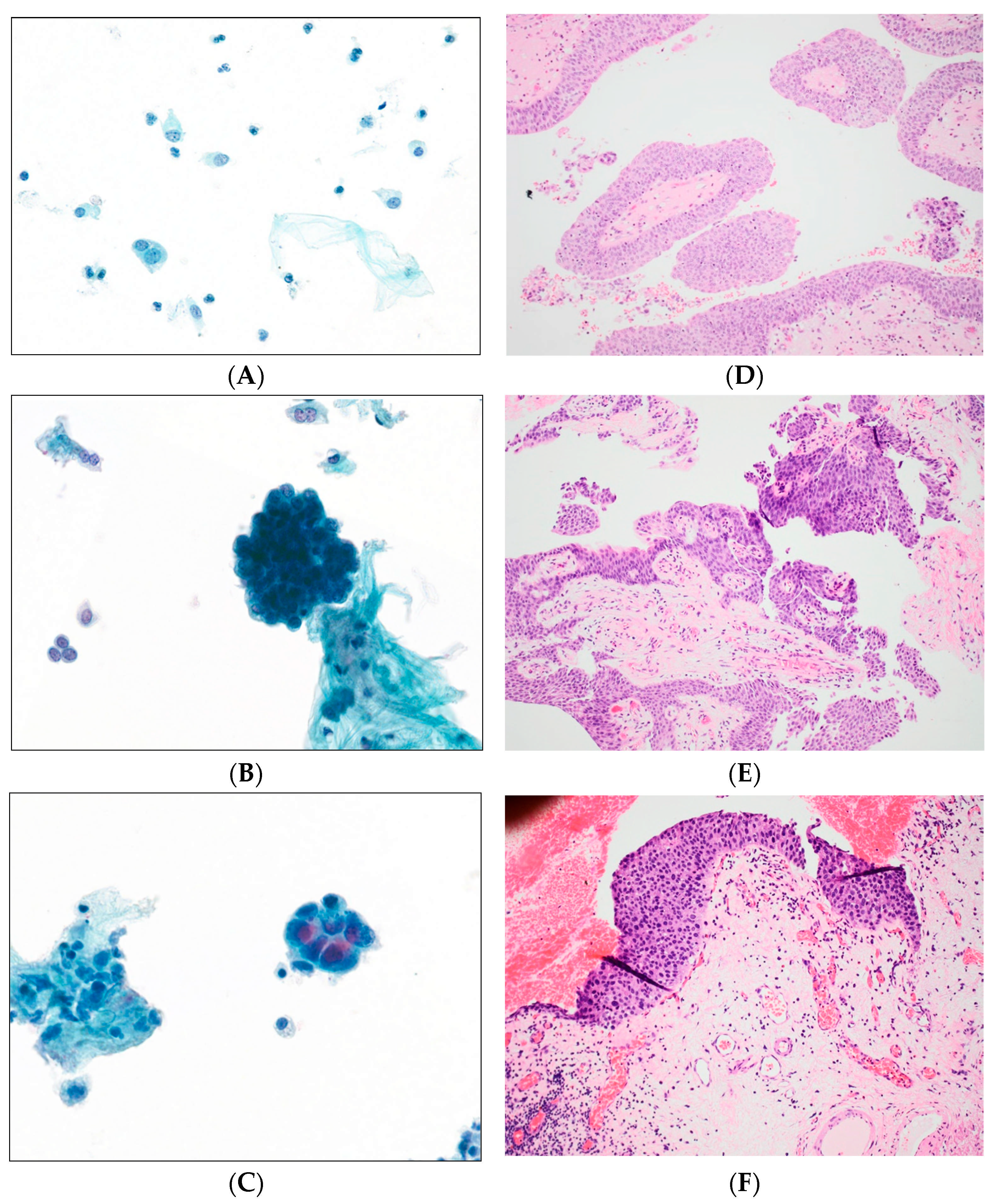 Cancers 17 01097 g002