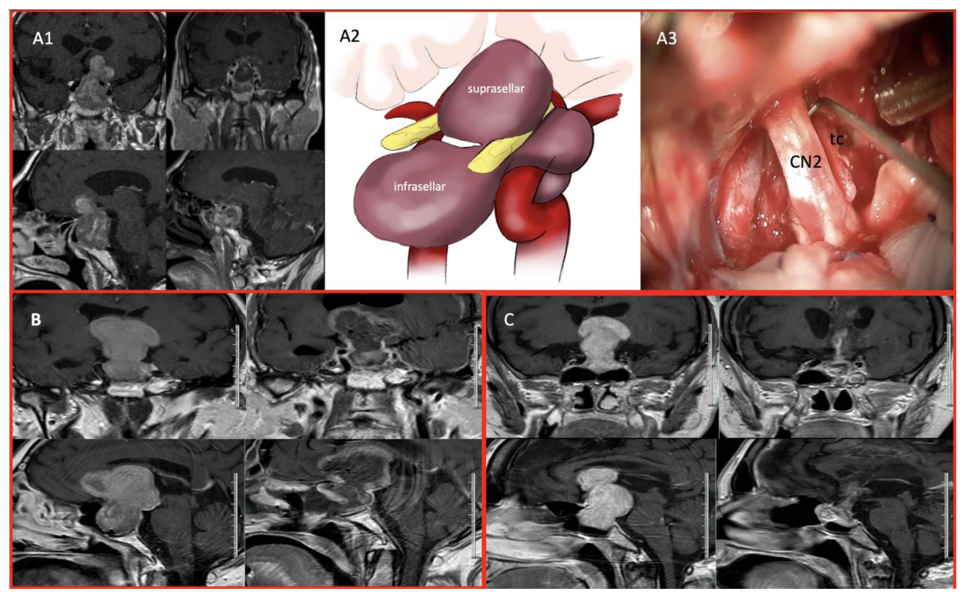 Cancers 17 01107 g002