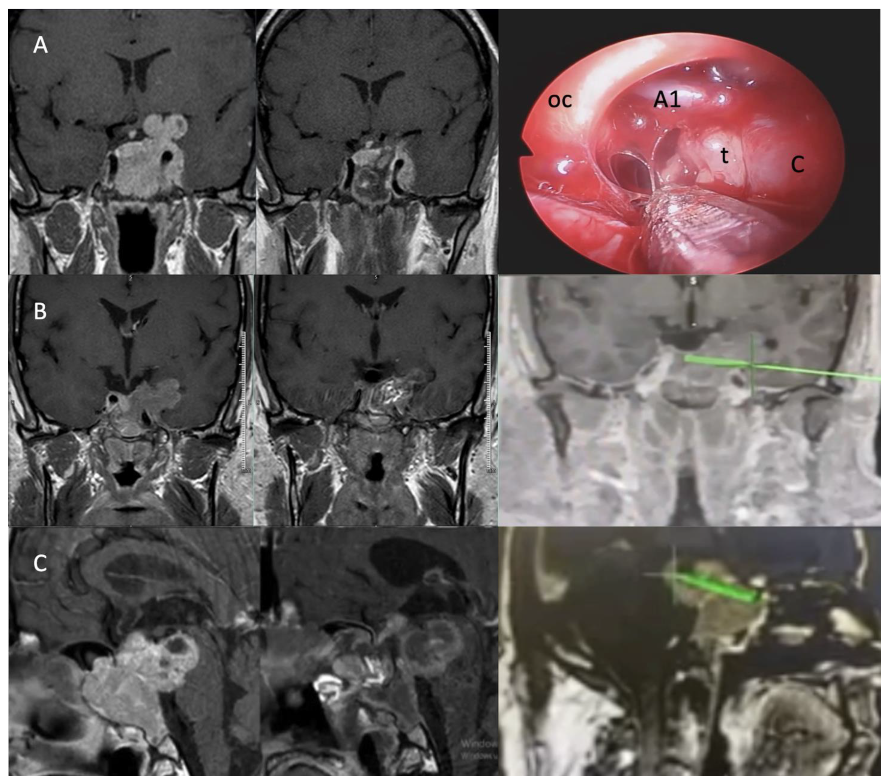 Cancers 17 01107 g003