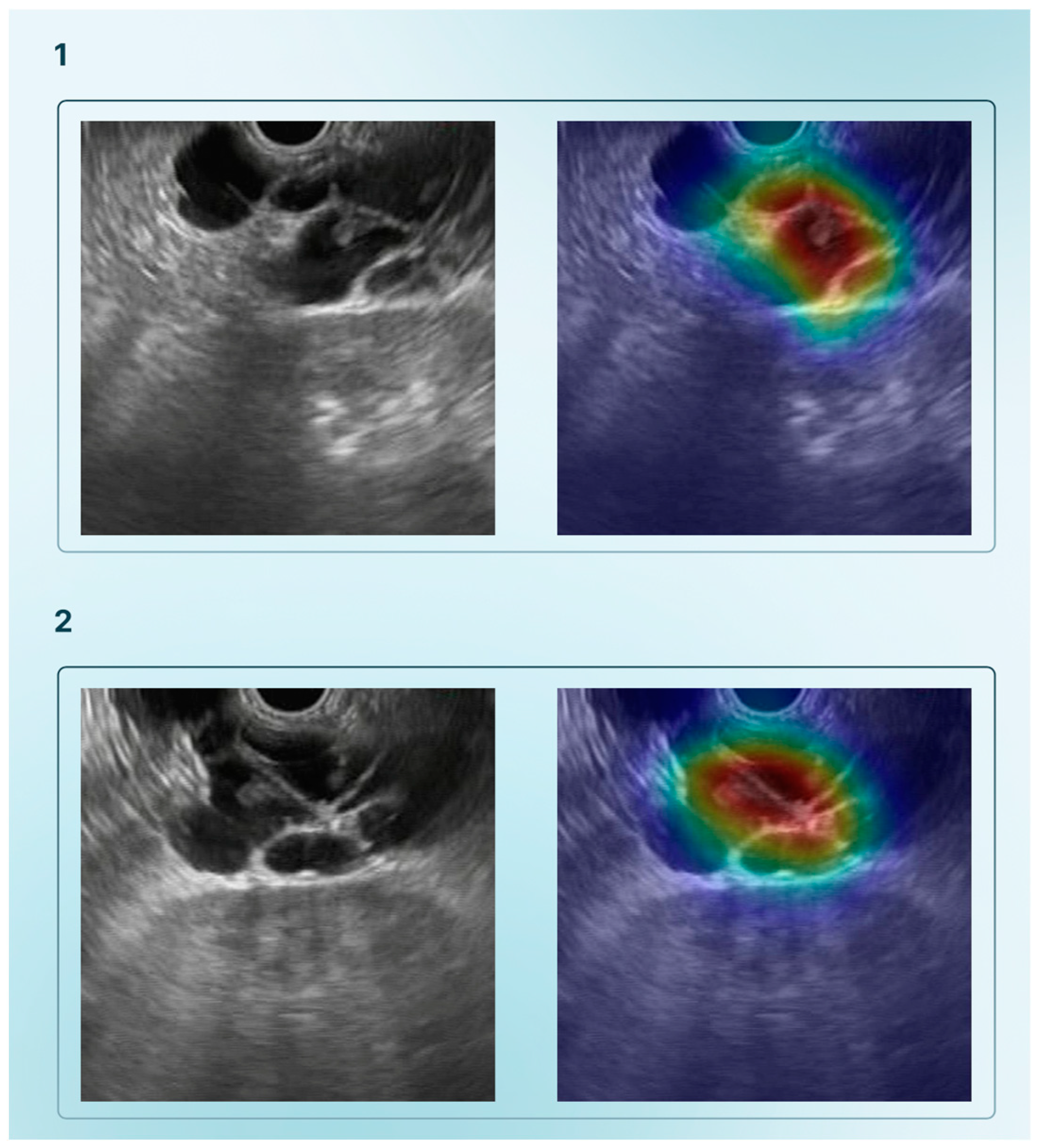 Cancers 17 01132 g001