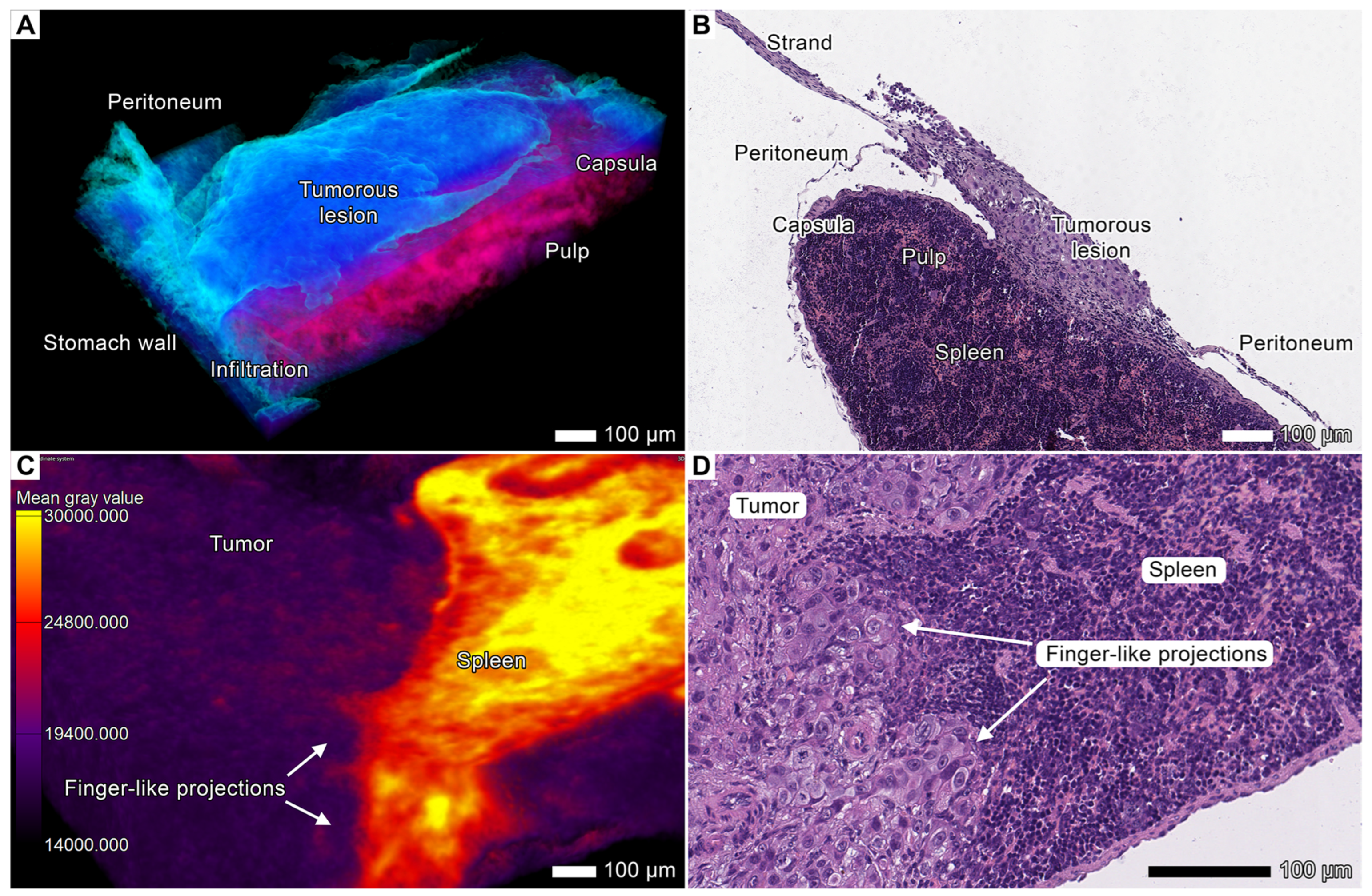 Cancers 17 01139 g003