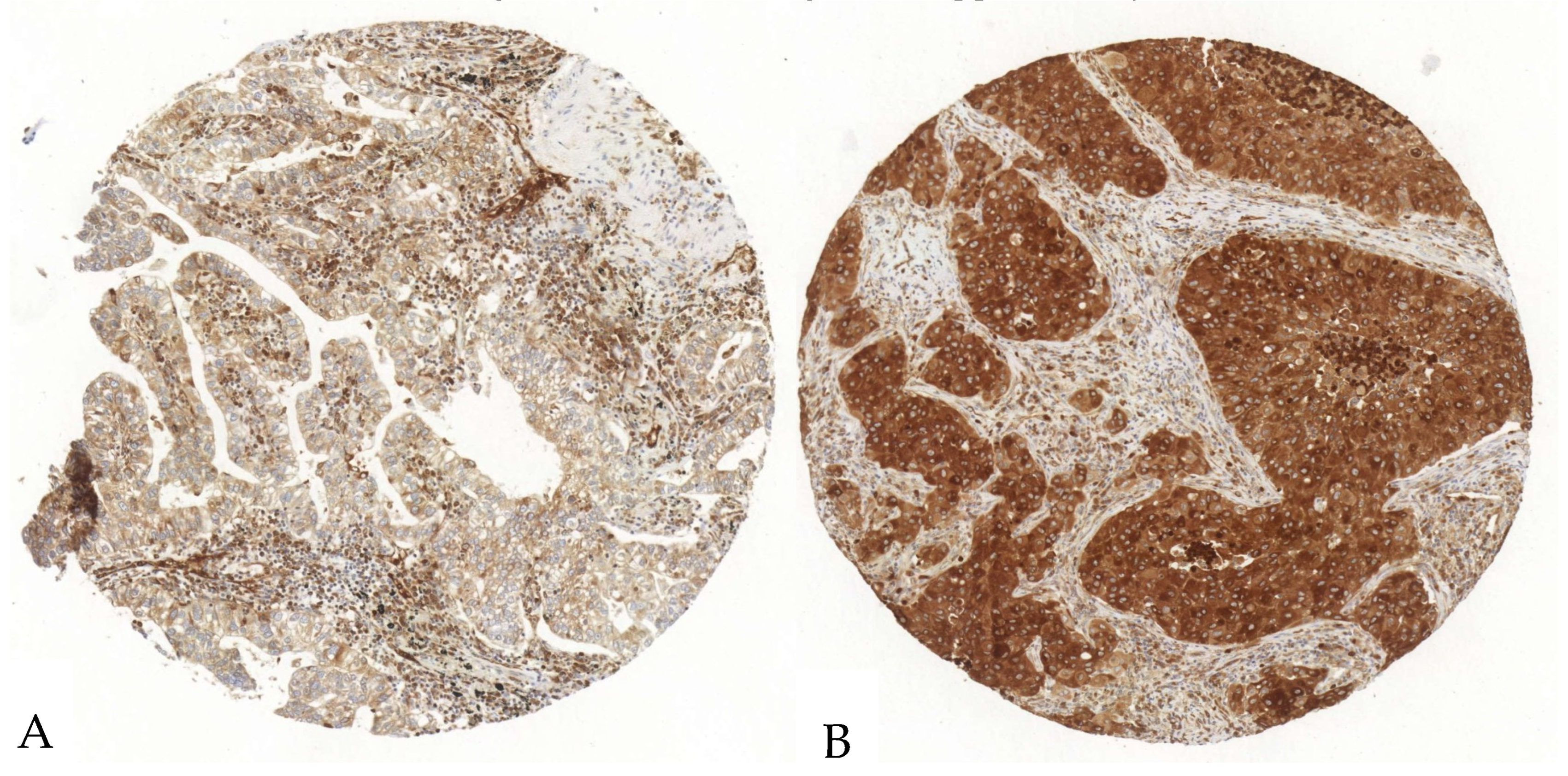 Cancers 17 01142 g003