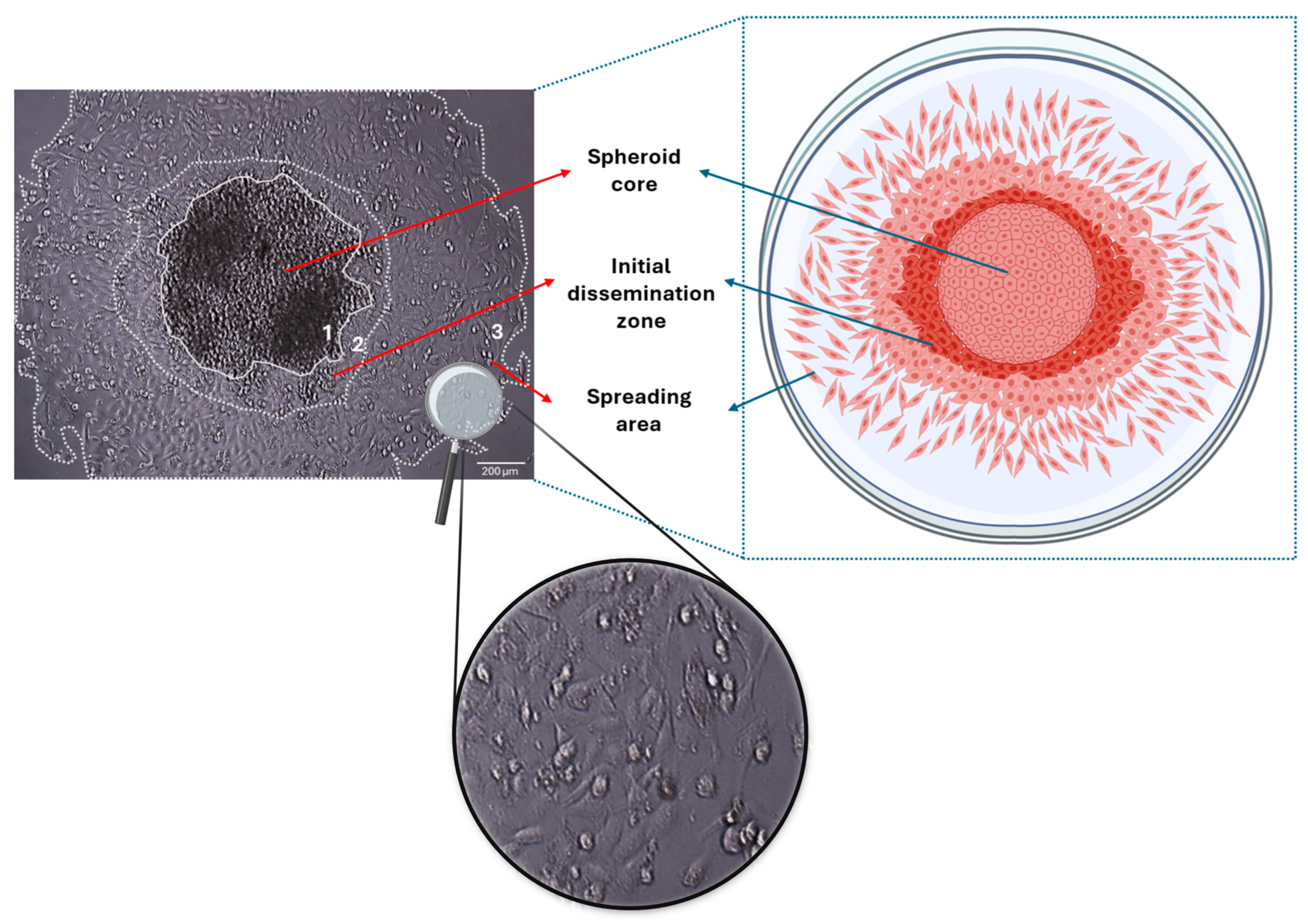 Cancers 17 01161 g002